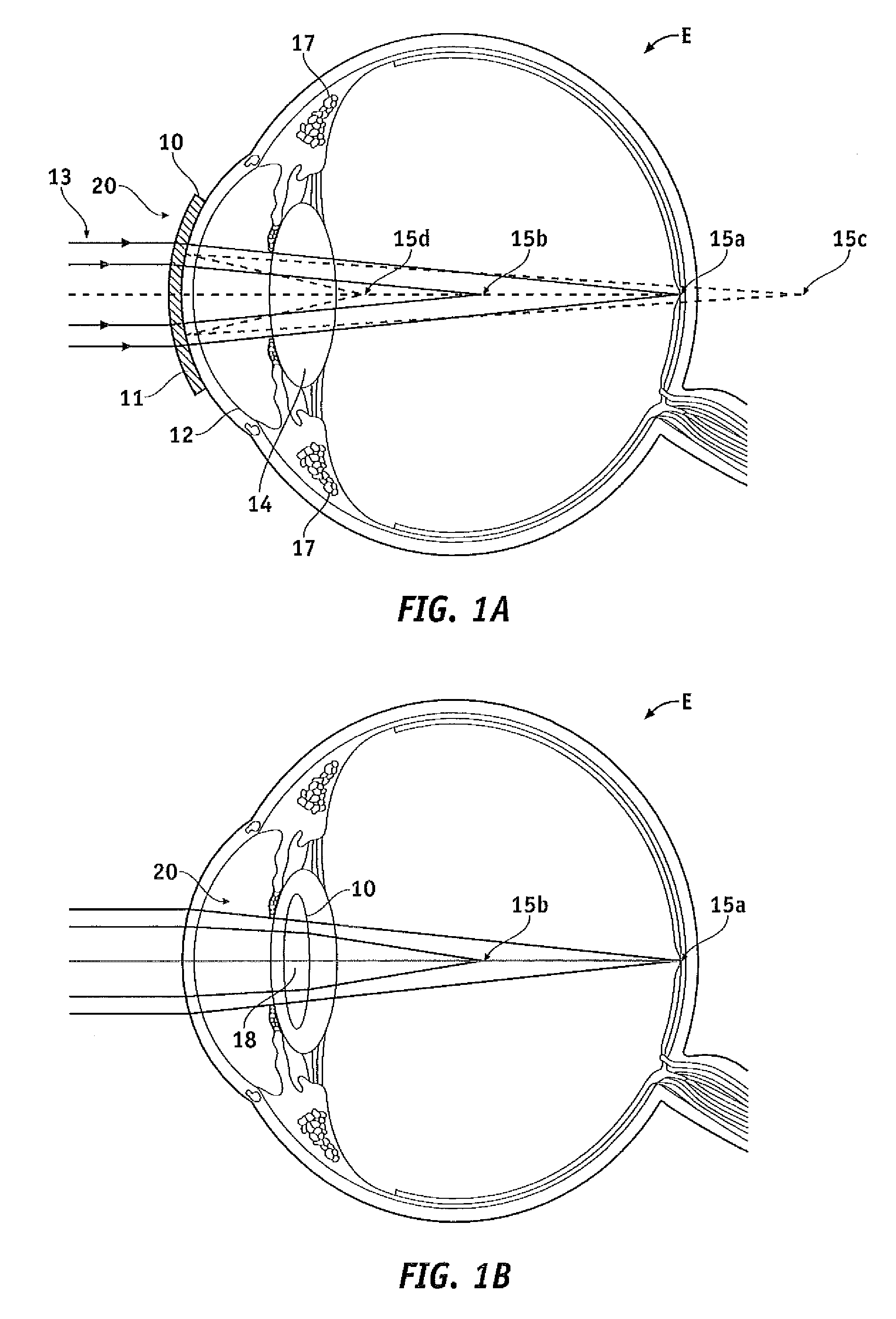 Pupil dependent diffractive lens for near, intermediate, and far vision