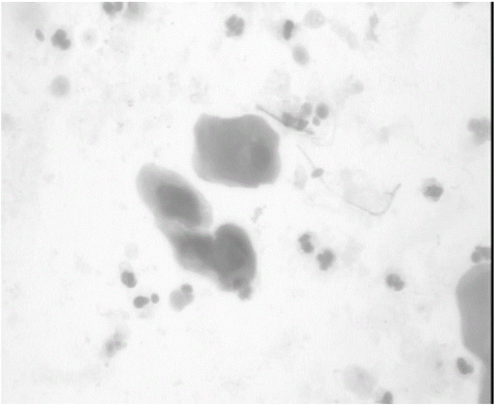 Papanicolaou staining solution and preparation method thereof