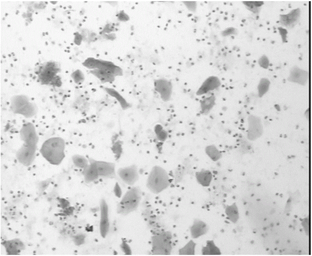 Papanicolaou staining solution and preparation method thereof