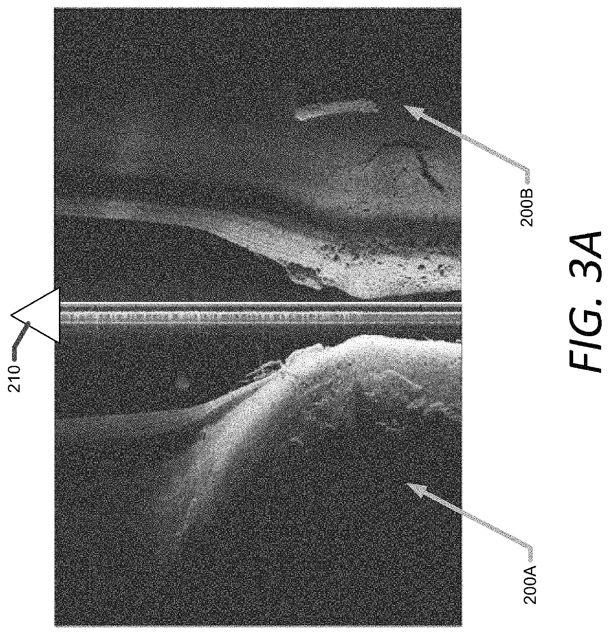 Marine electronic device for presentment of sonar images