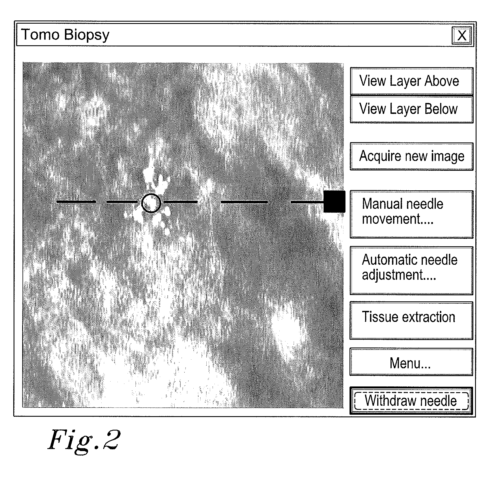 Method and Arrangement Relating to X-Ray Imaging