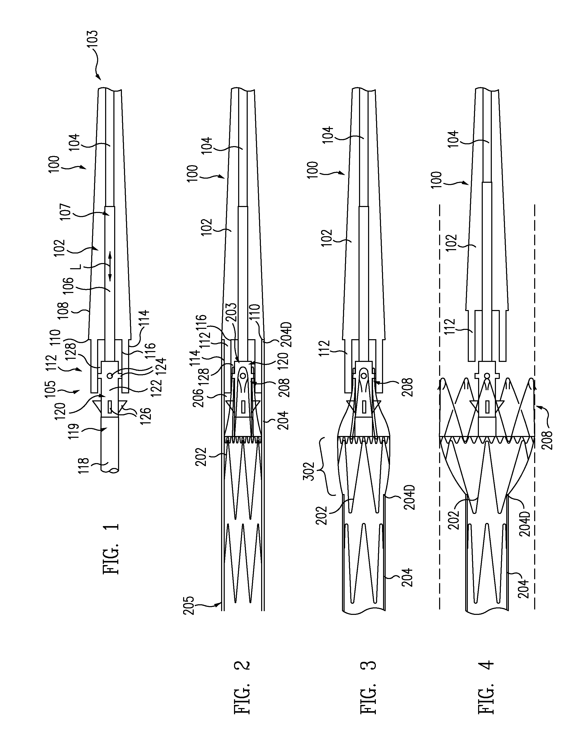 Delivery System for Stent-Graft With Anchoring Pins