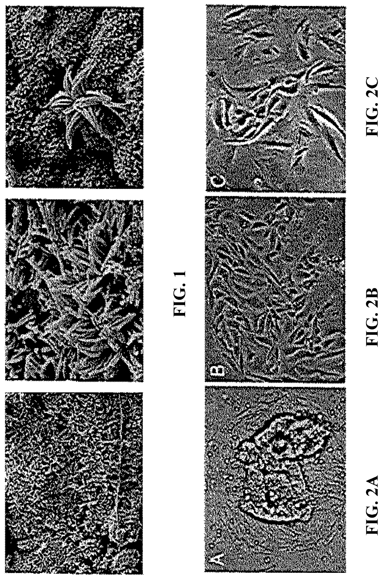 Scaffolds for uterine cell growth