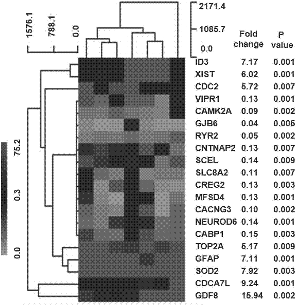 Diagnostic marker for malignant glioma