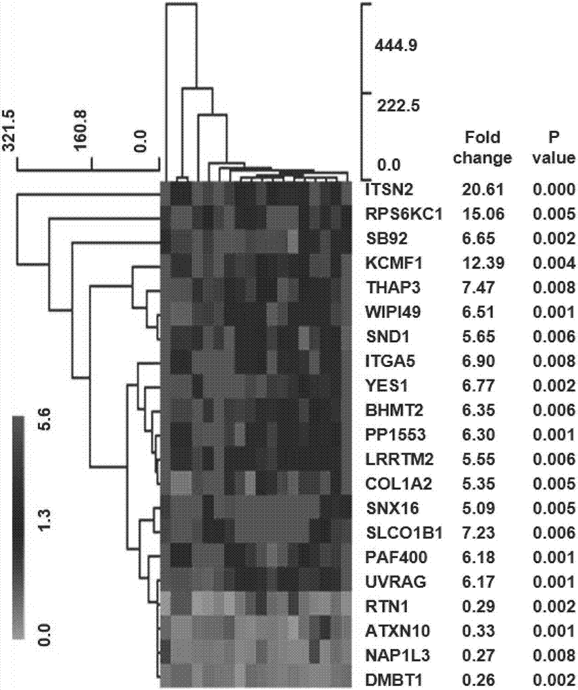 Diagnostic marker for malignant glioma