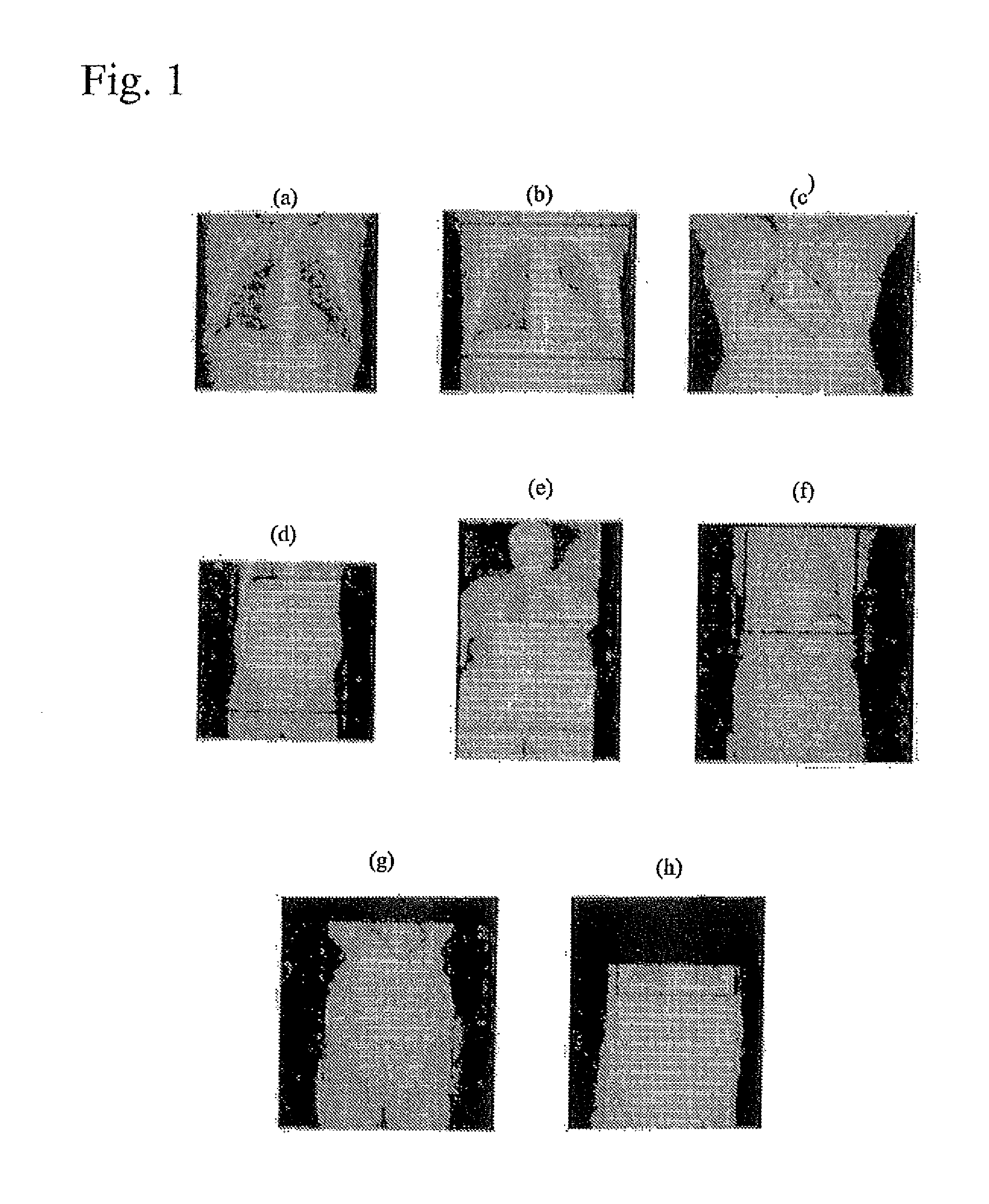 Systems and Methods for Robust Learning Based Annotation of Medical Radiographs