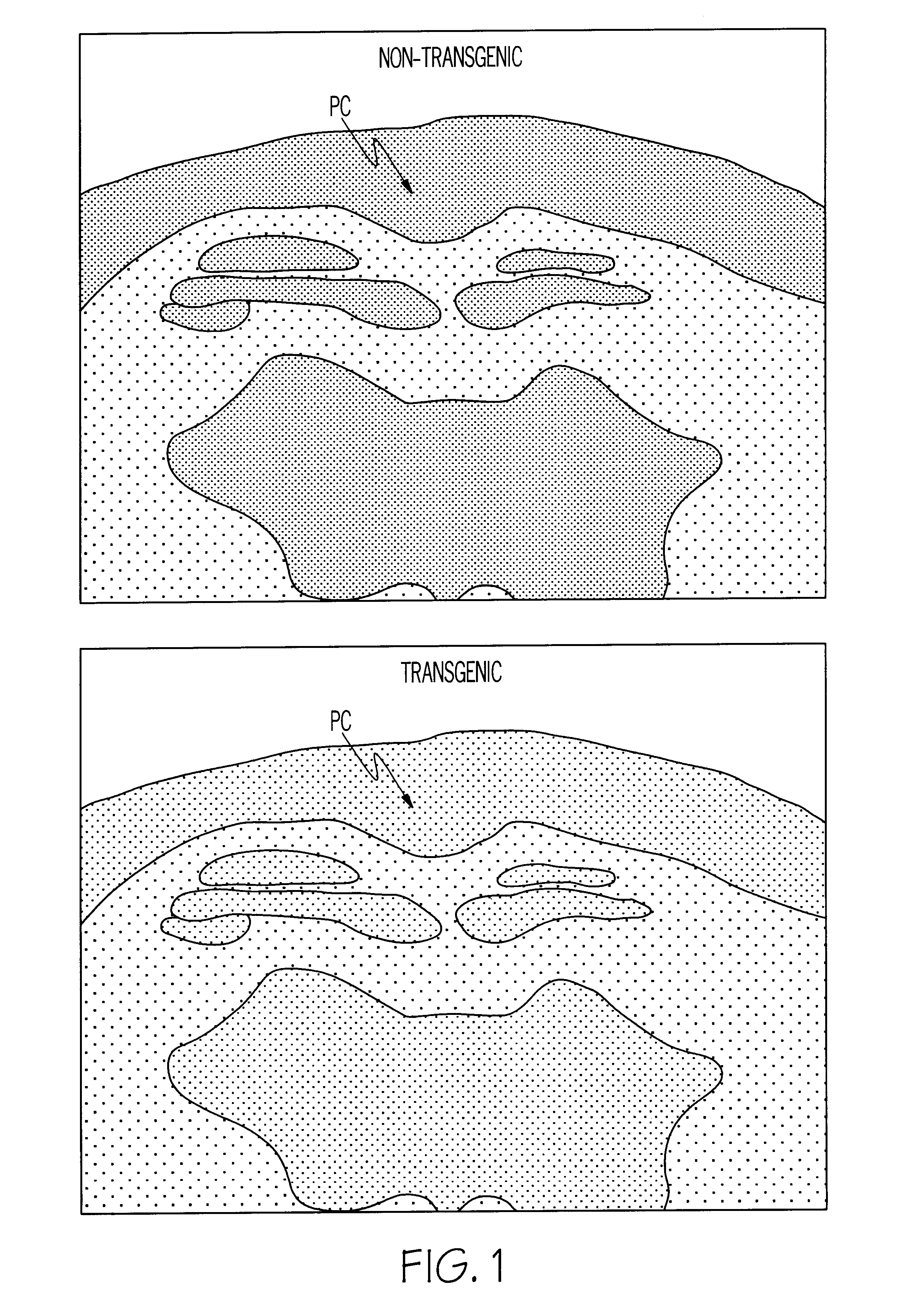 Methods for tracking the progression of Alzheimer's disease identifying treatment using transgenic mice