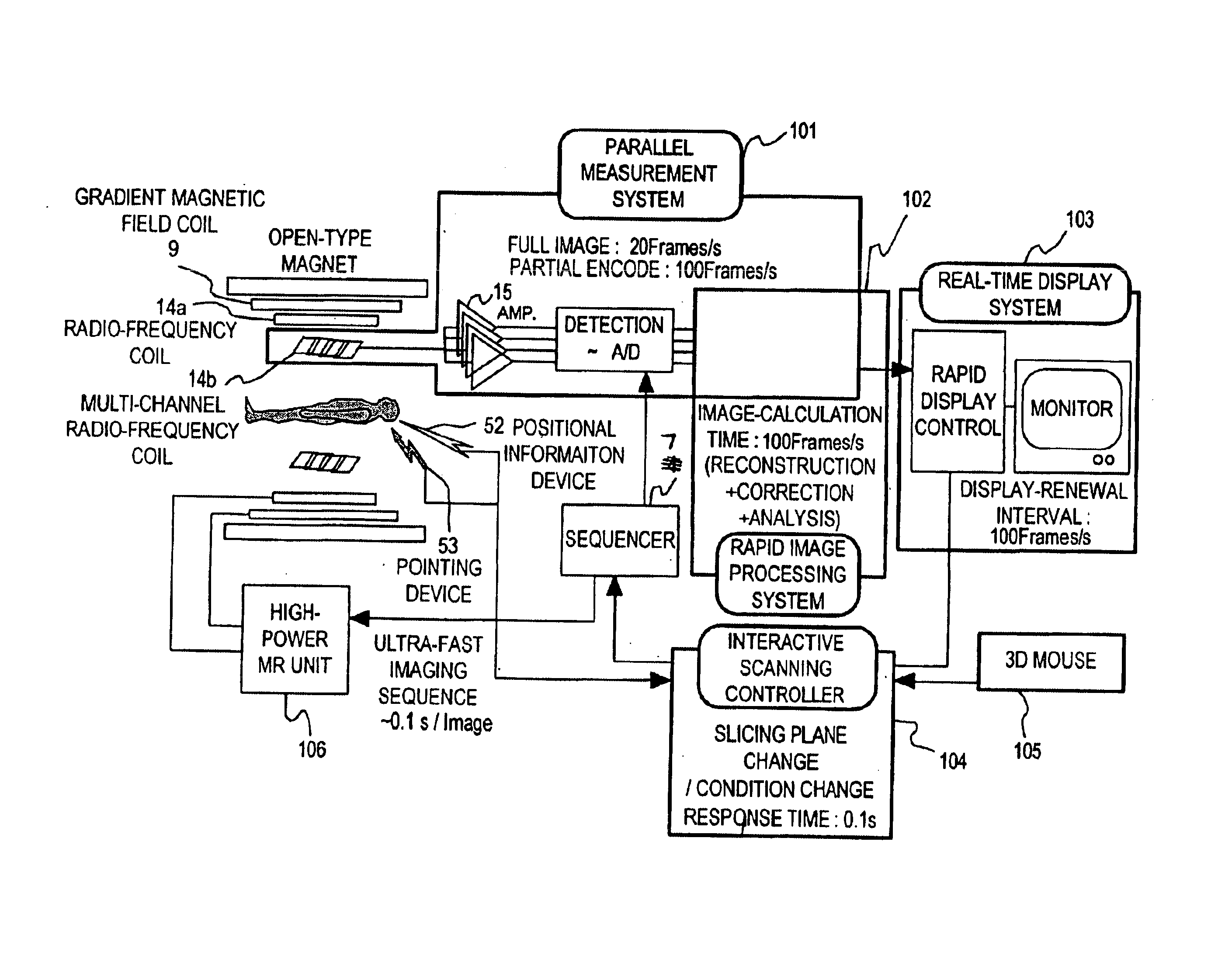 Magnetic resonance imaging system