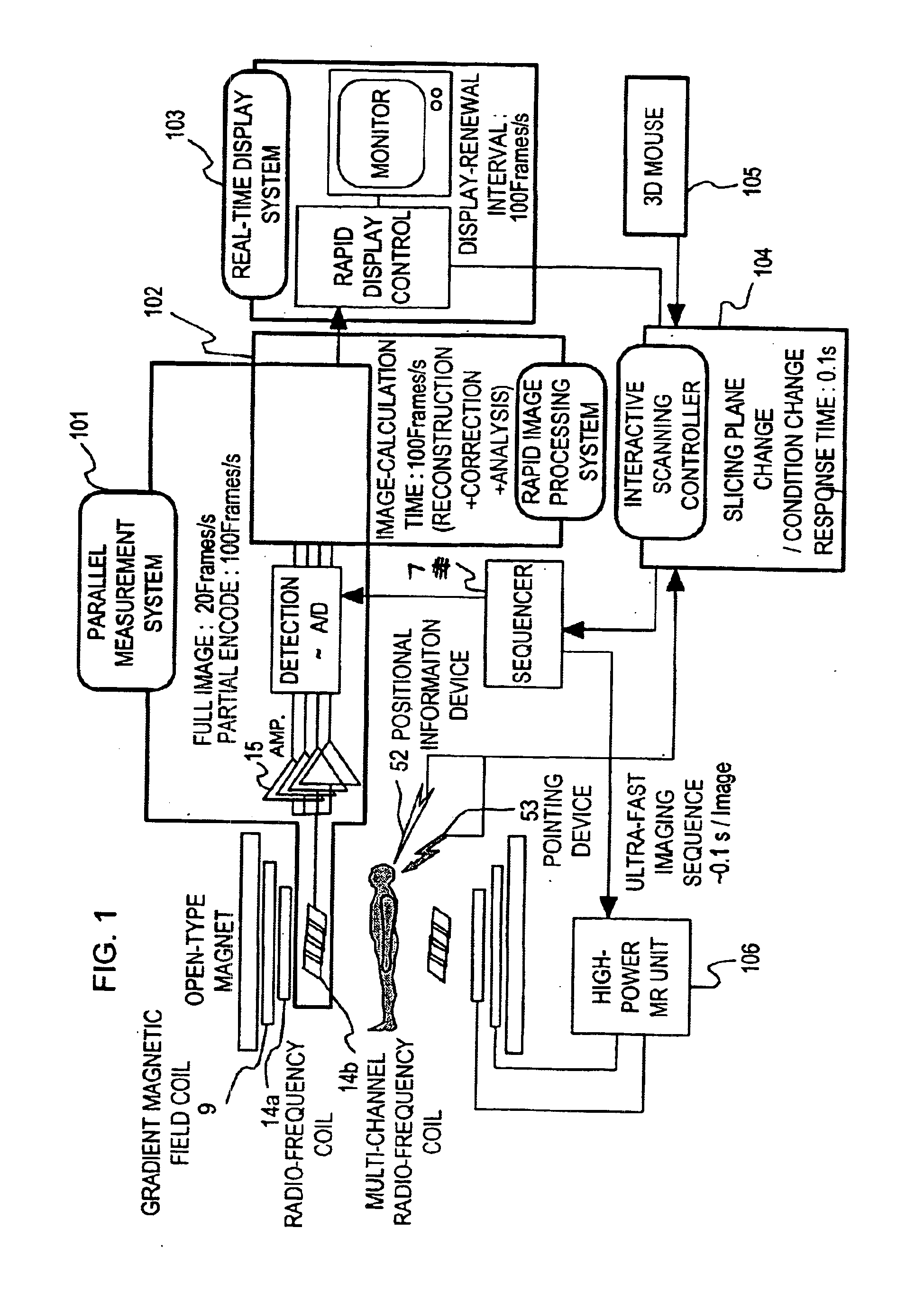 Magnetic resonance imaging system