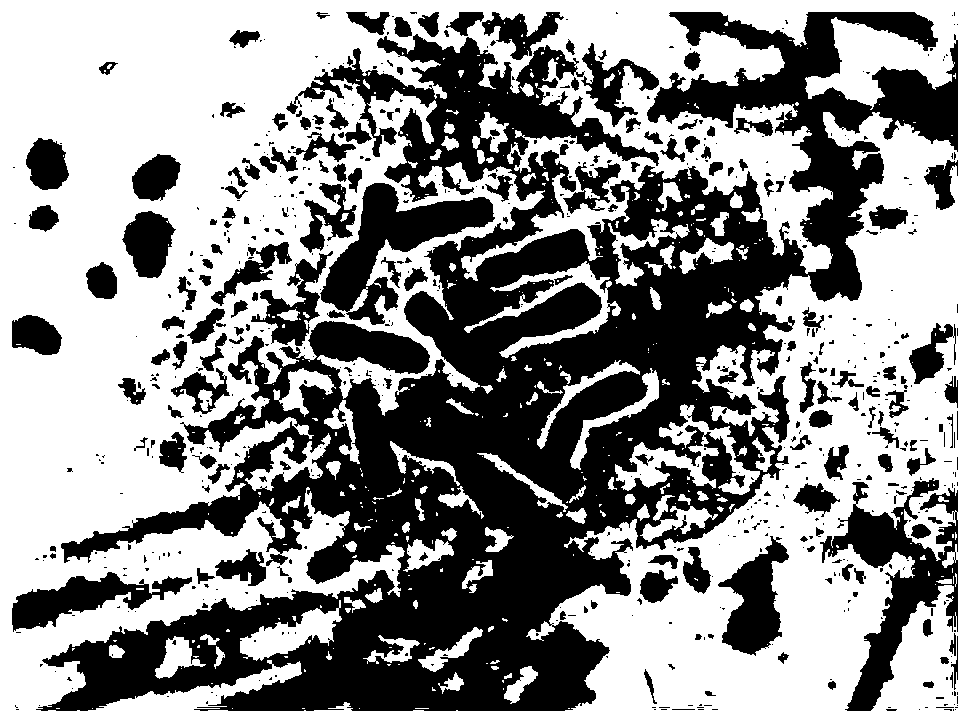 Method for preparing paeonia plant root tip chromosome slice