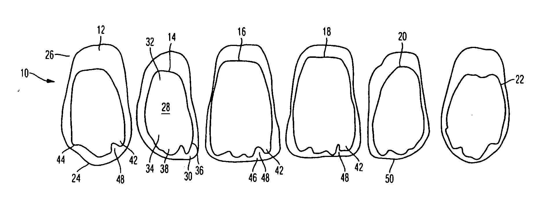 Incisor tooth or canine tooth, and set of teeth, and method for producing and incisor tooth or canine tooth