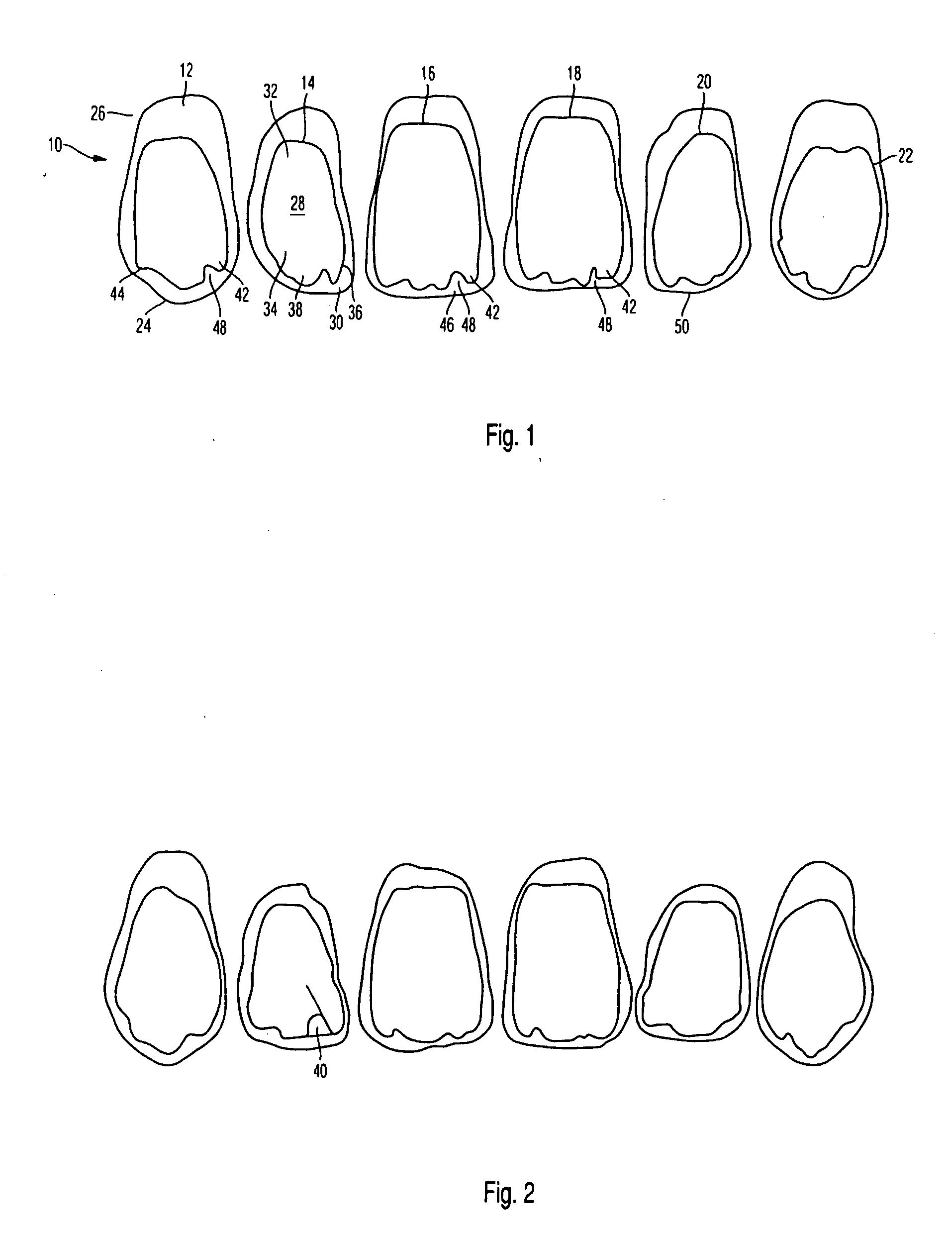 Incisor tooth or canine tooth, and set of teeth, and method for producing and incisor tooth or canine tooth