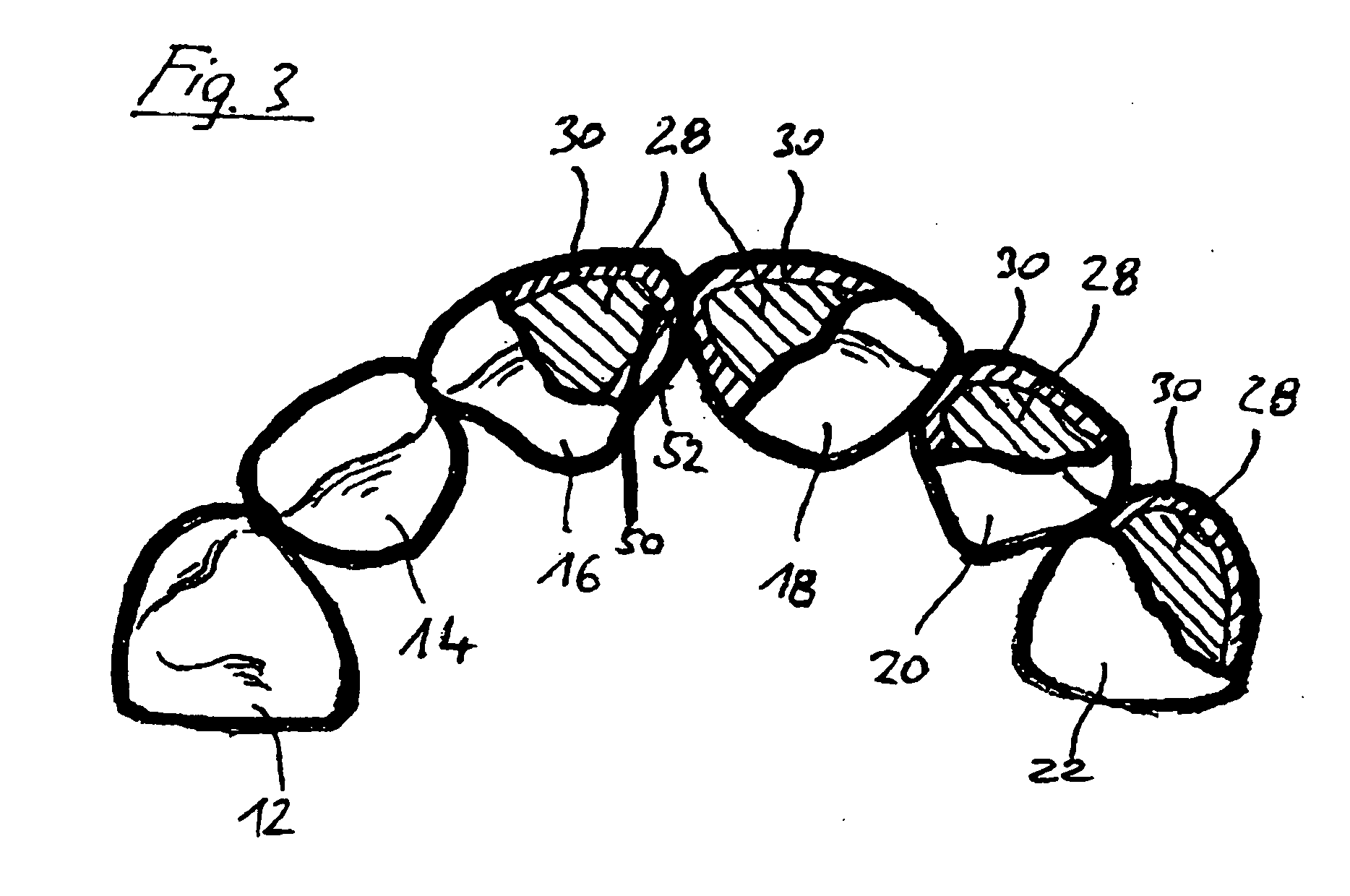 Incisor tooth or canine tooth, and set of teeth, and method for producing and incisor tooth or canine tooth