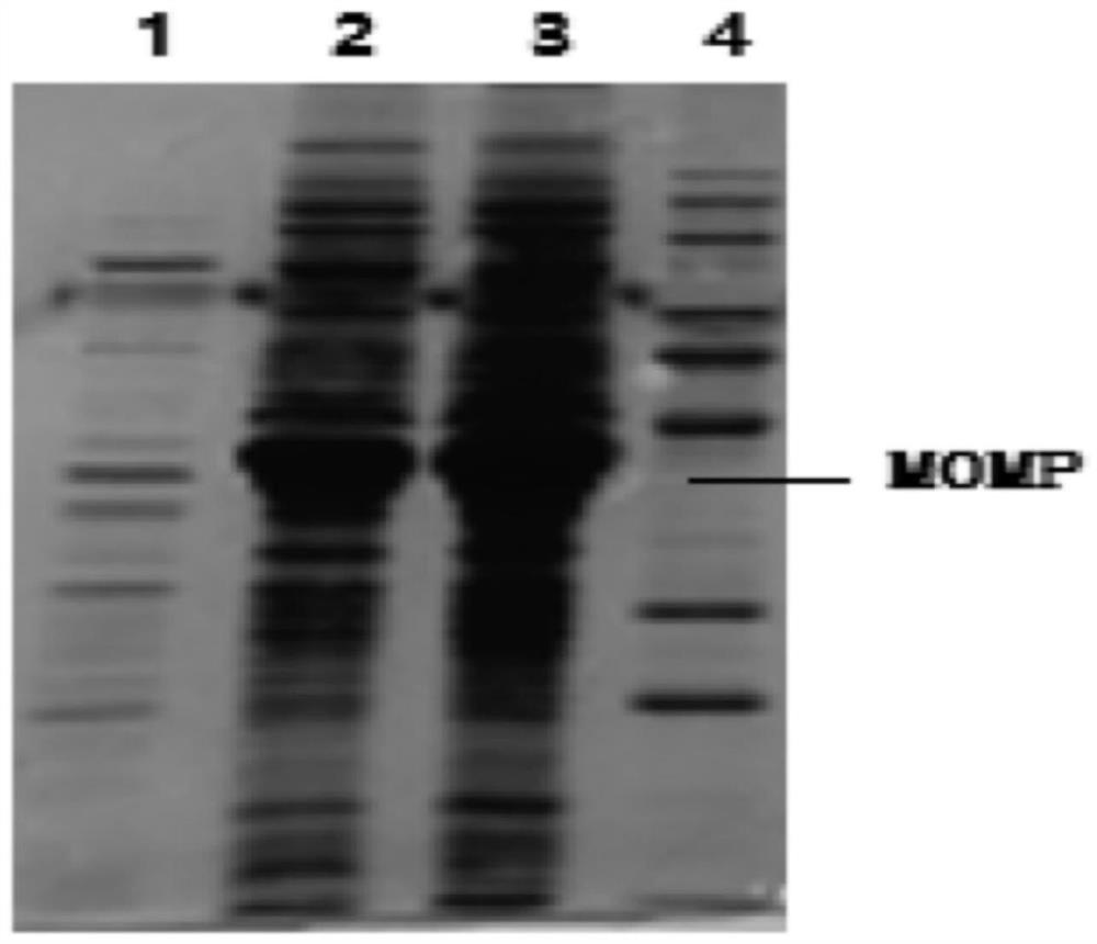 A dual inactivated vaccine for Mycoplasma ovine pneumonia and Chlamydia psittacosis and preparation method thereof