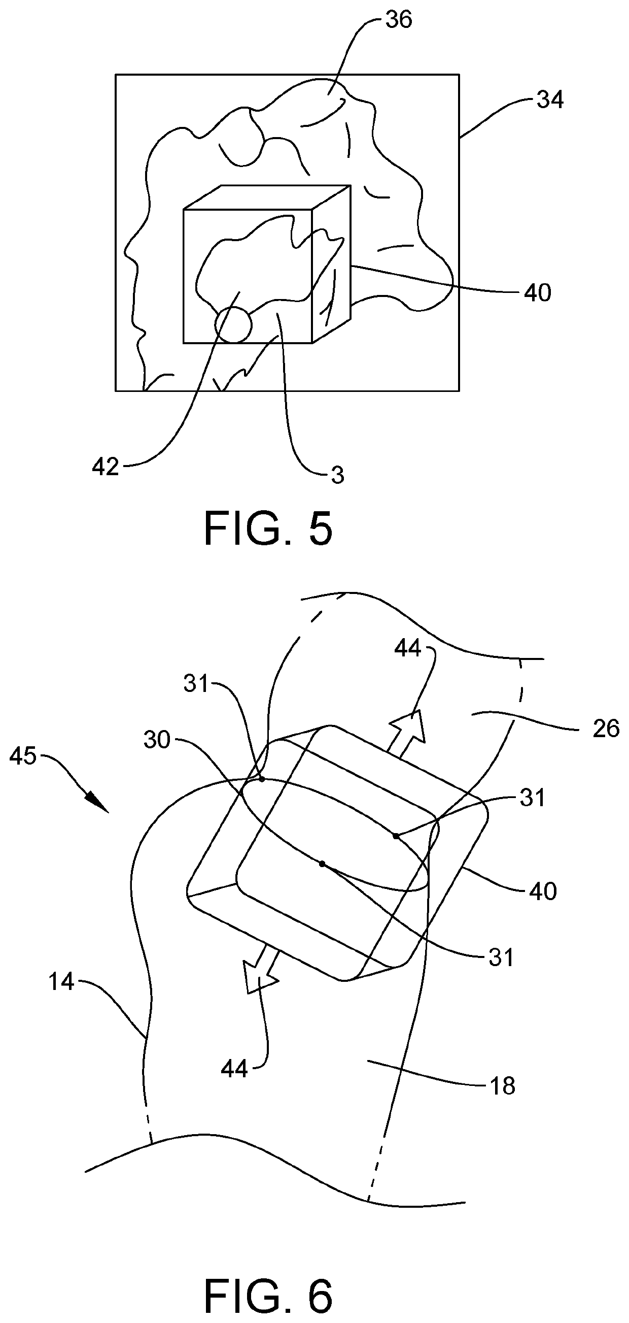 Method of visualizing a dynamic anatomical structure