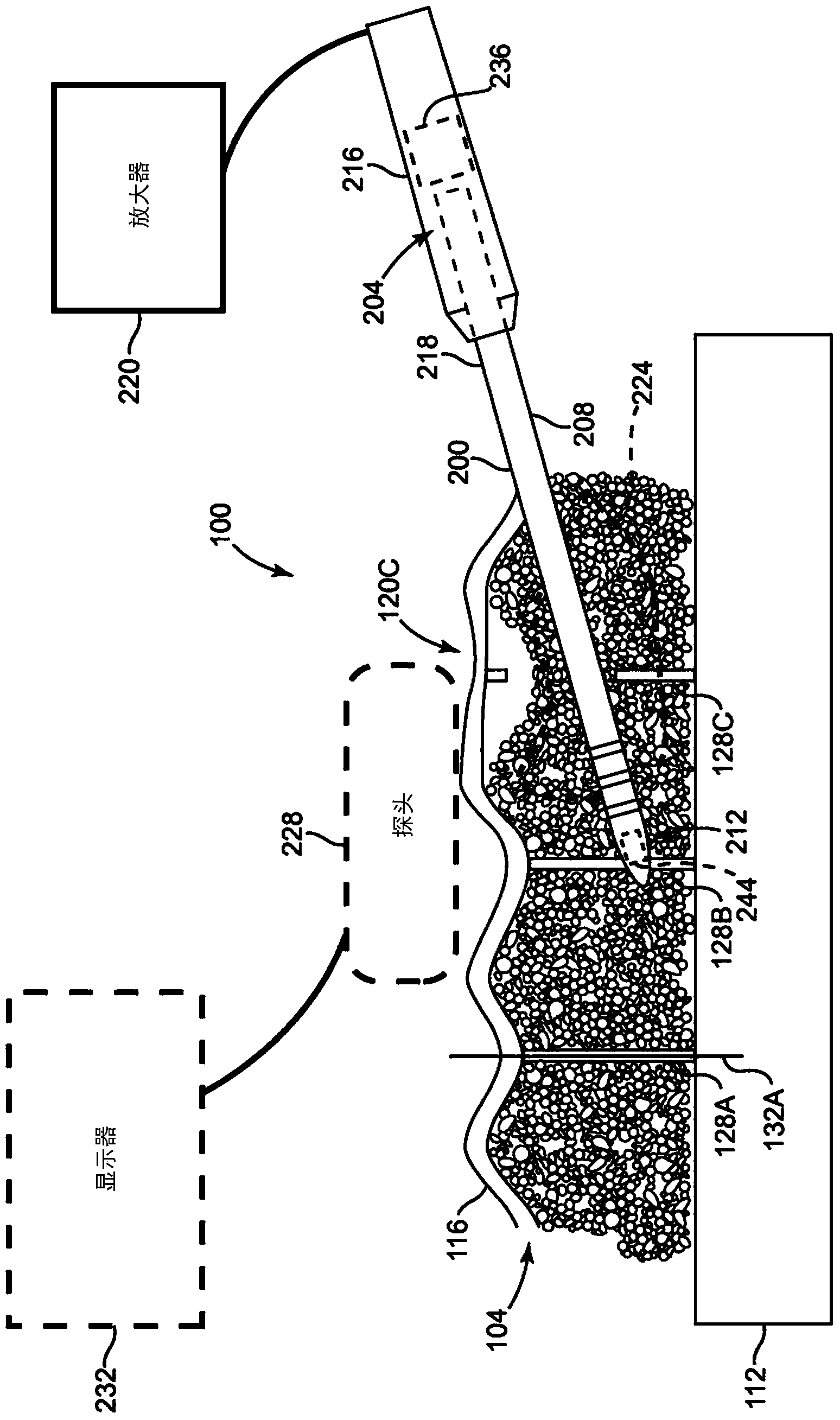 Ultrasonic probe for treating cellulite