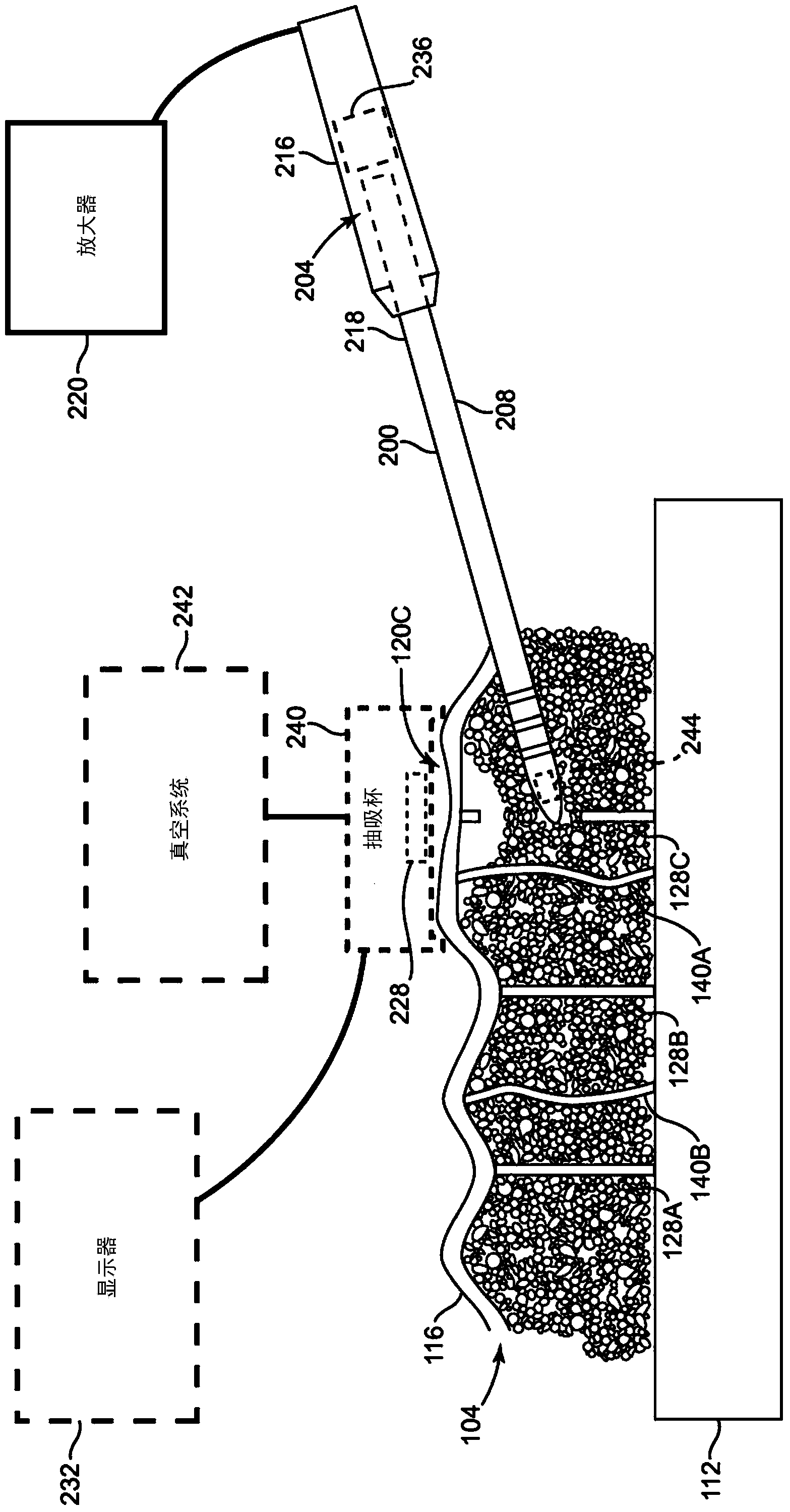 Ultrasonic probe for treating cellulite