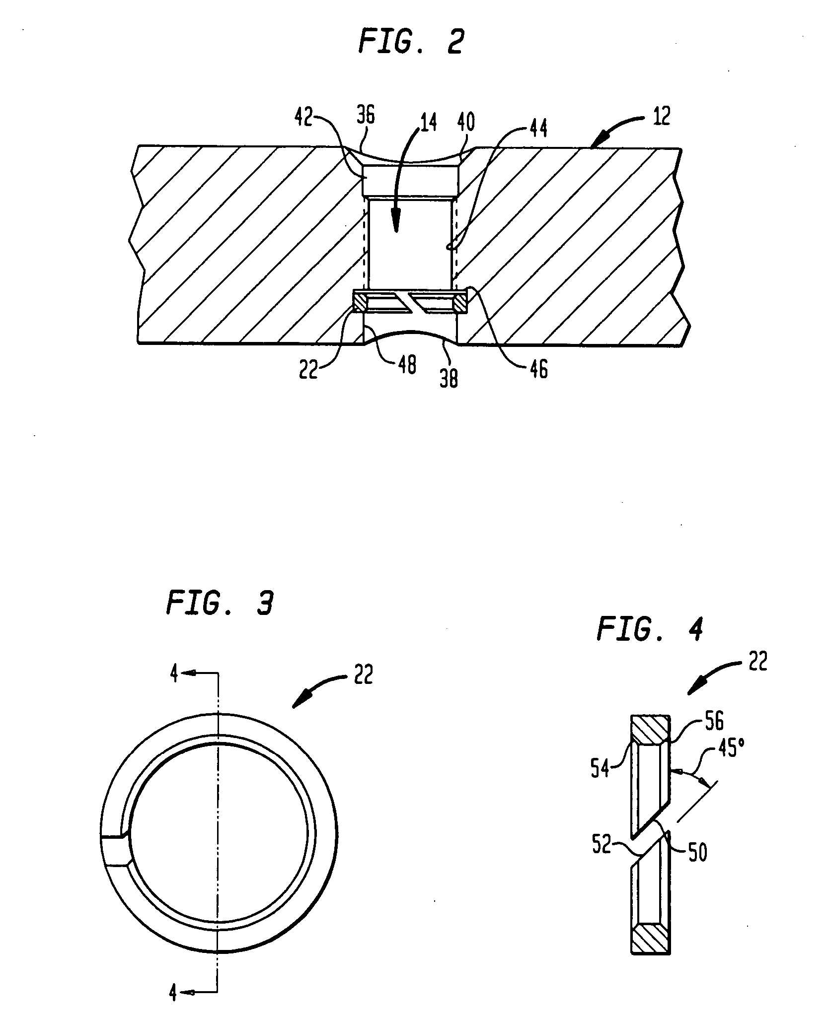 Implant for osteosynthesis