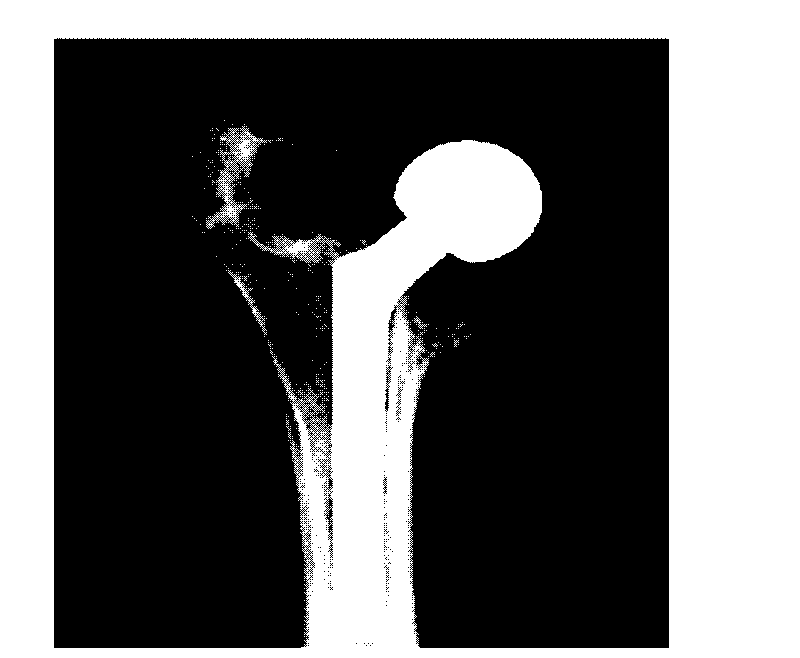 Method for strengthening joint stability by using rhBMP-2 release coating on surface of artificial joint