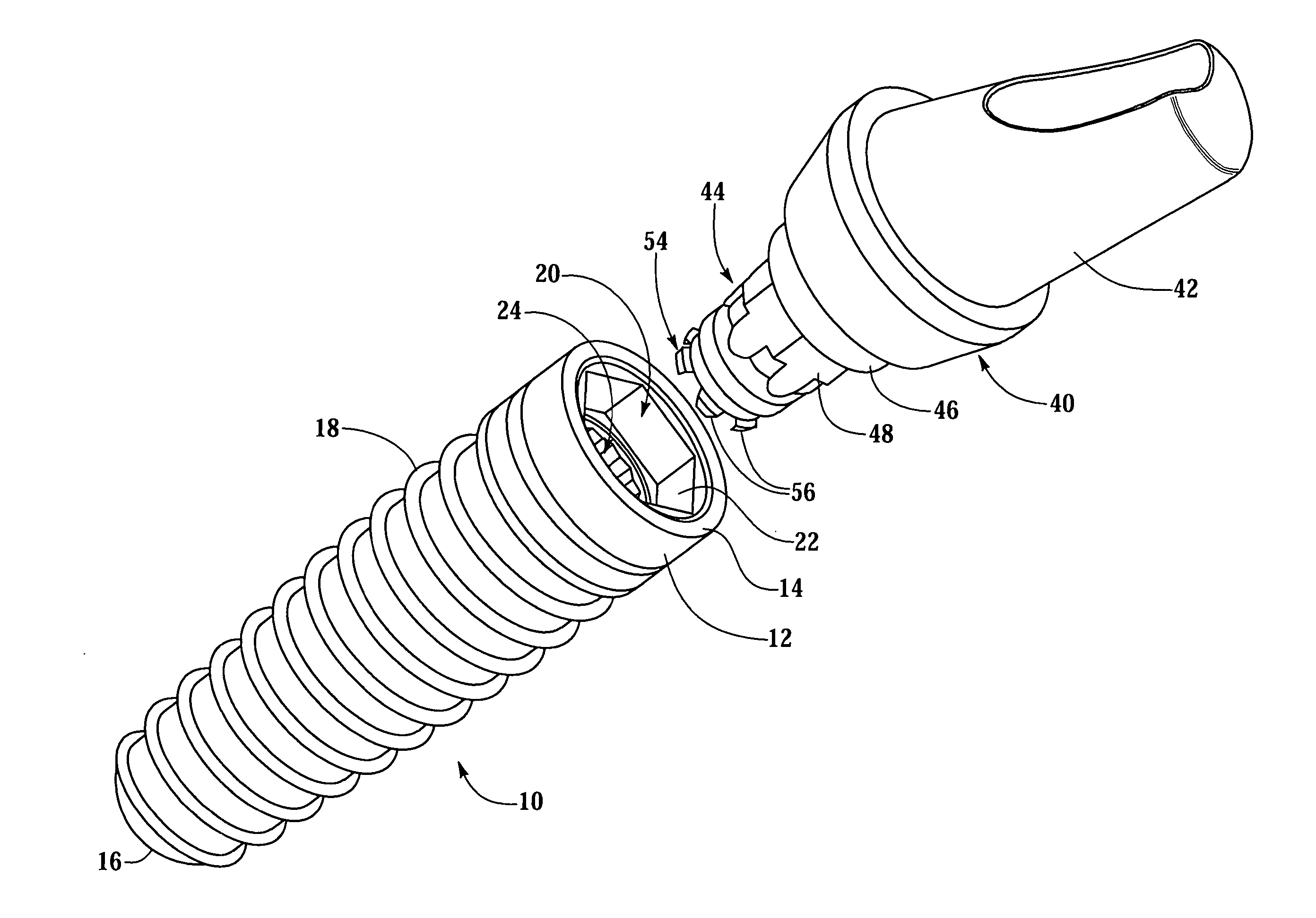 Dental implant system