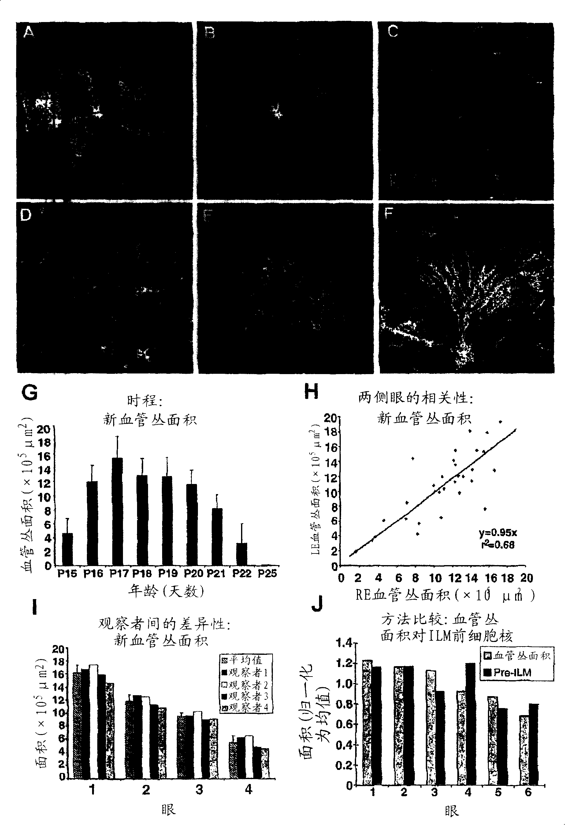 Revascularization of ischemic retinal tissue and screening method therefor