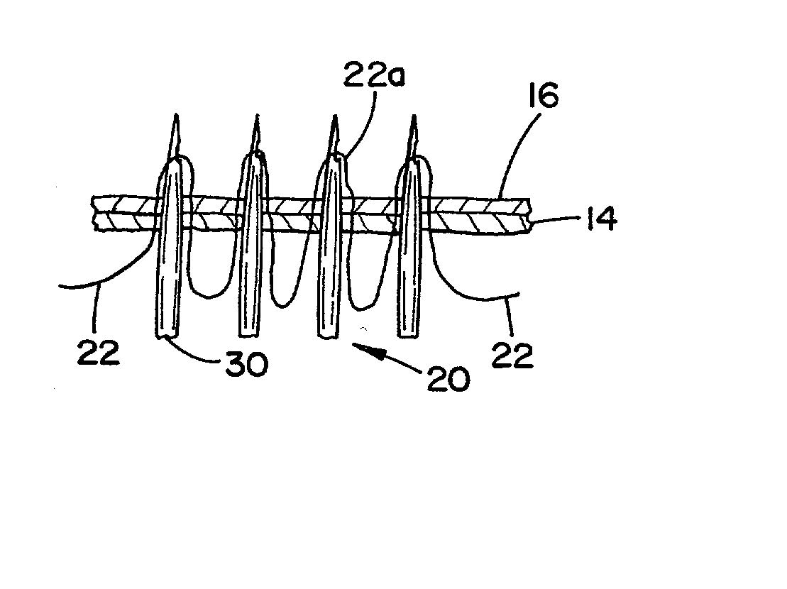 Needle array suturing/sewing anastomosis device and method for anastomosis