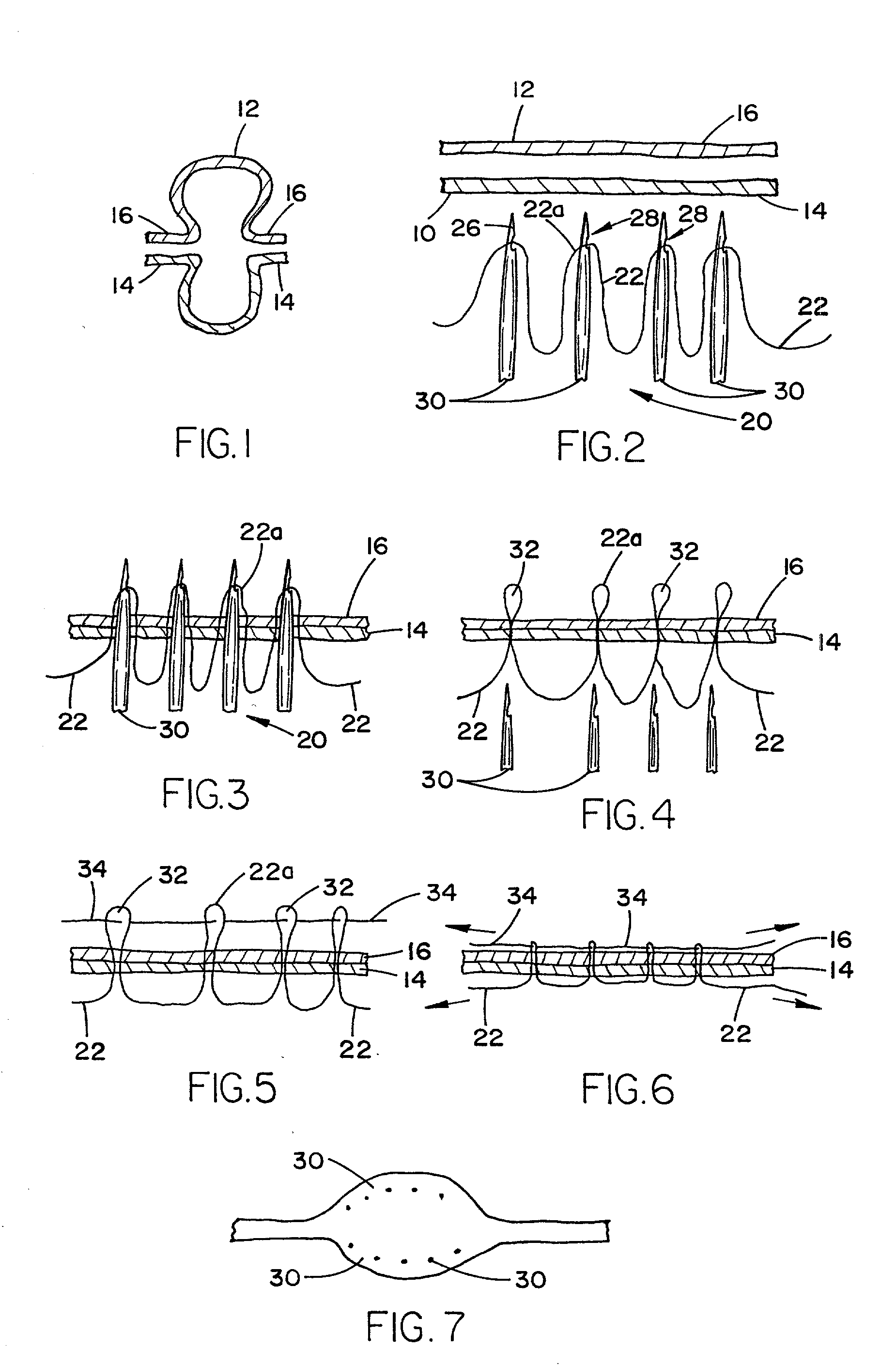 Needle array suturing/sewing anastomosis device and method for anastomosis