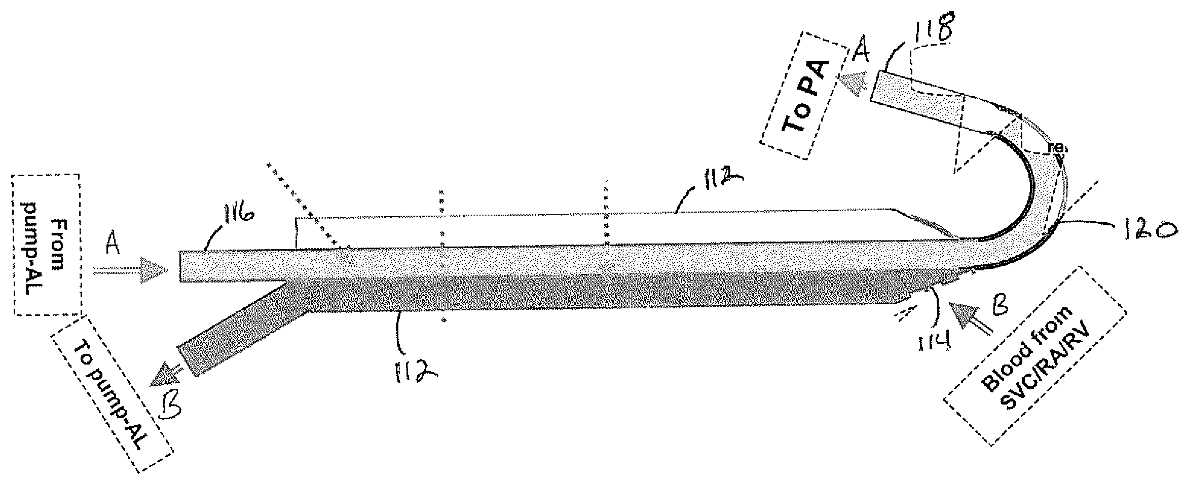 Blood access assembly for artificial lung and right ventricular assist device