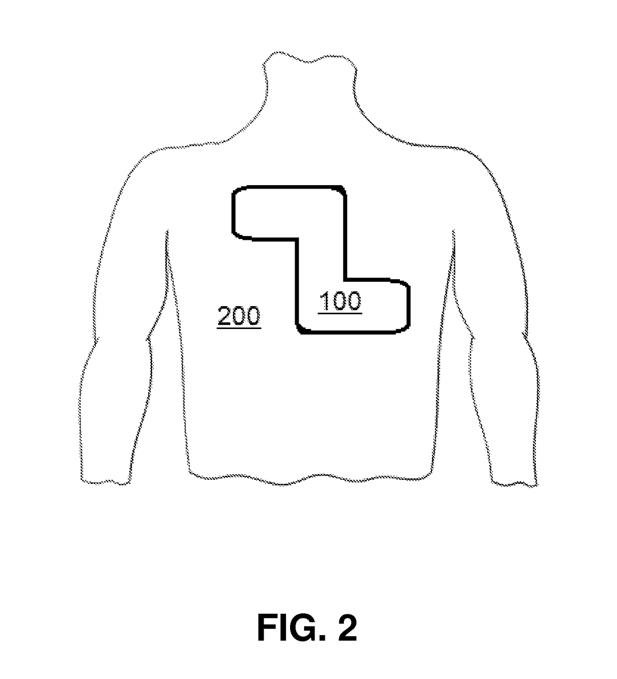 Delivery of electrode gel using CPR puck