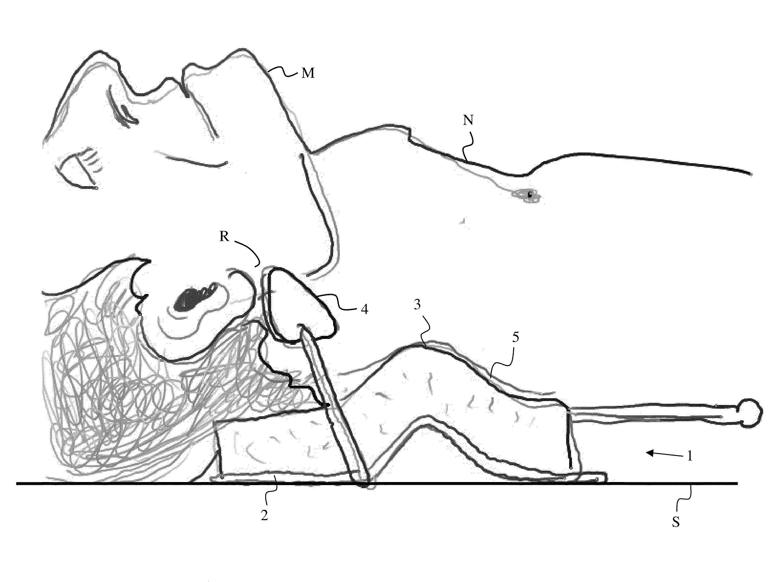 Jaw thrust device and method