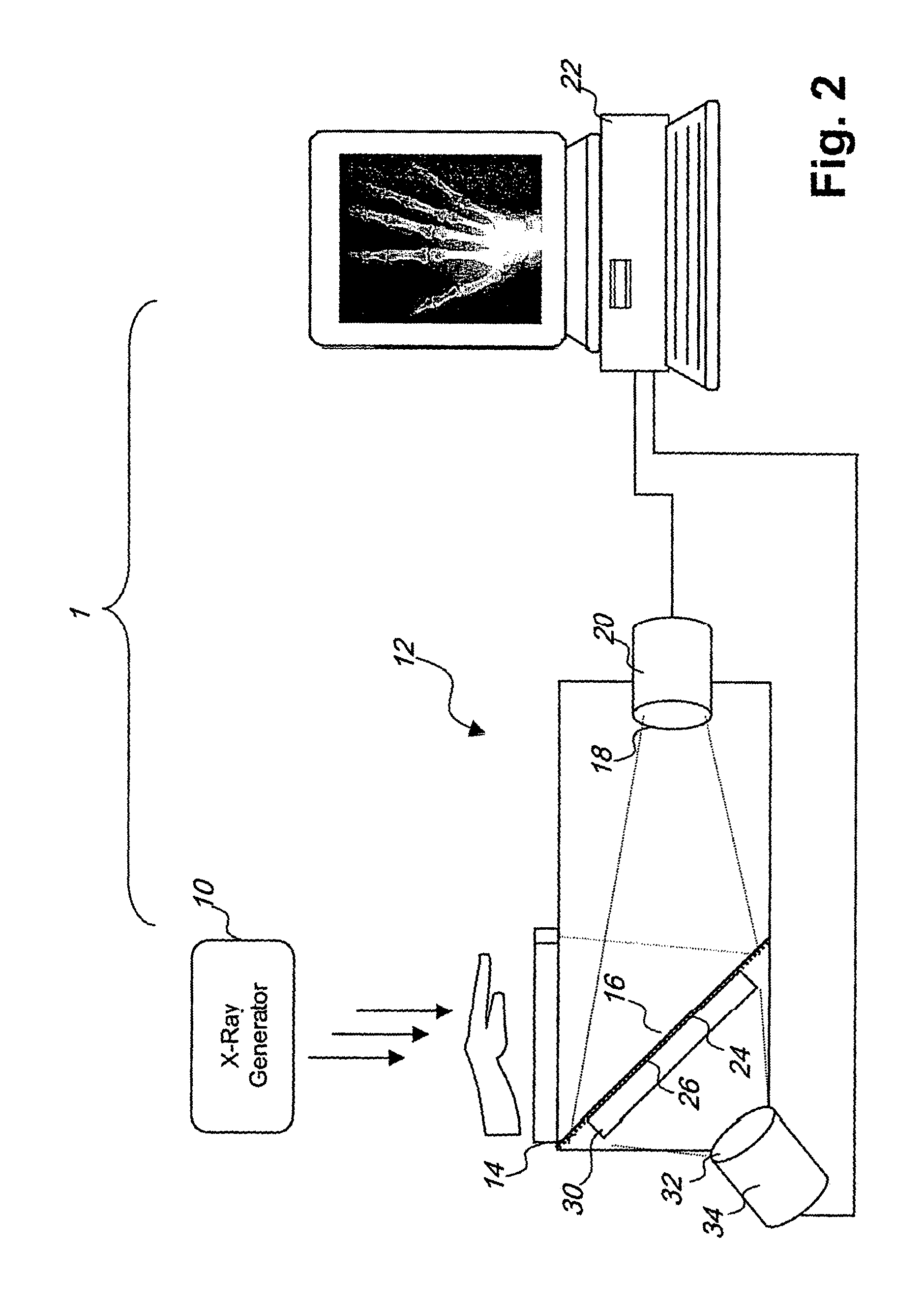 Dual energy imaging using optically coupled digital radiography system