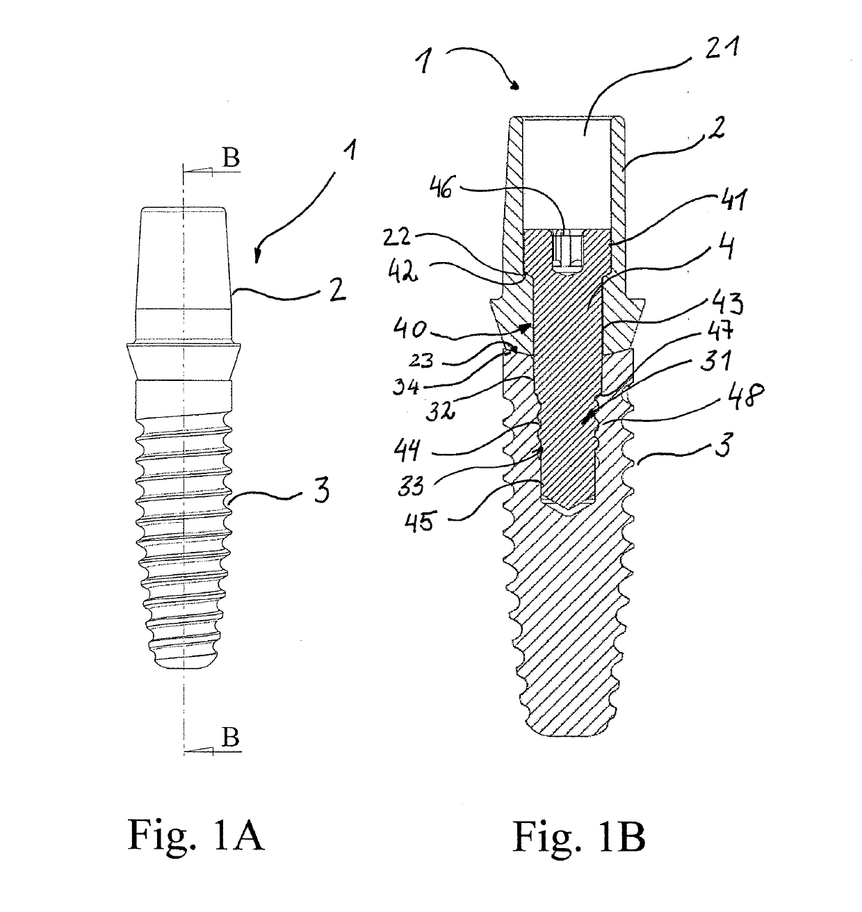 Dental prosthesis system