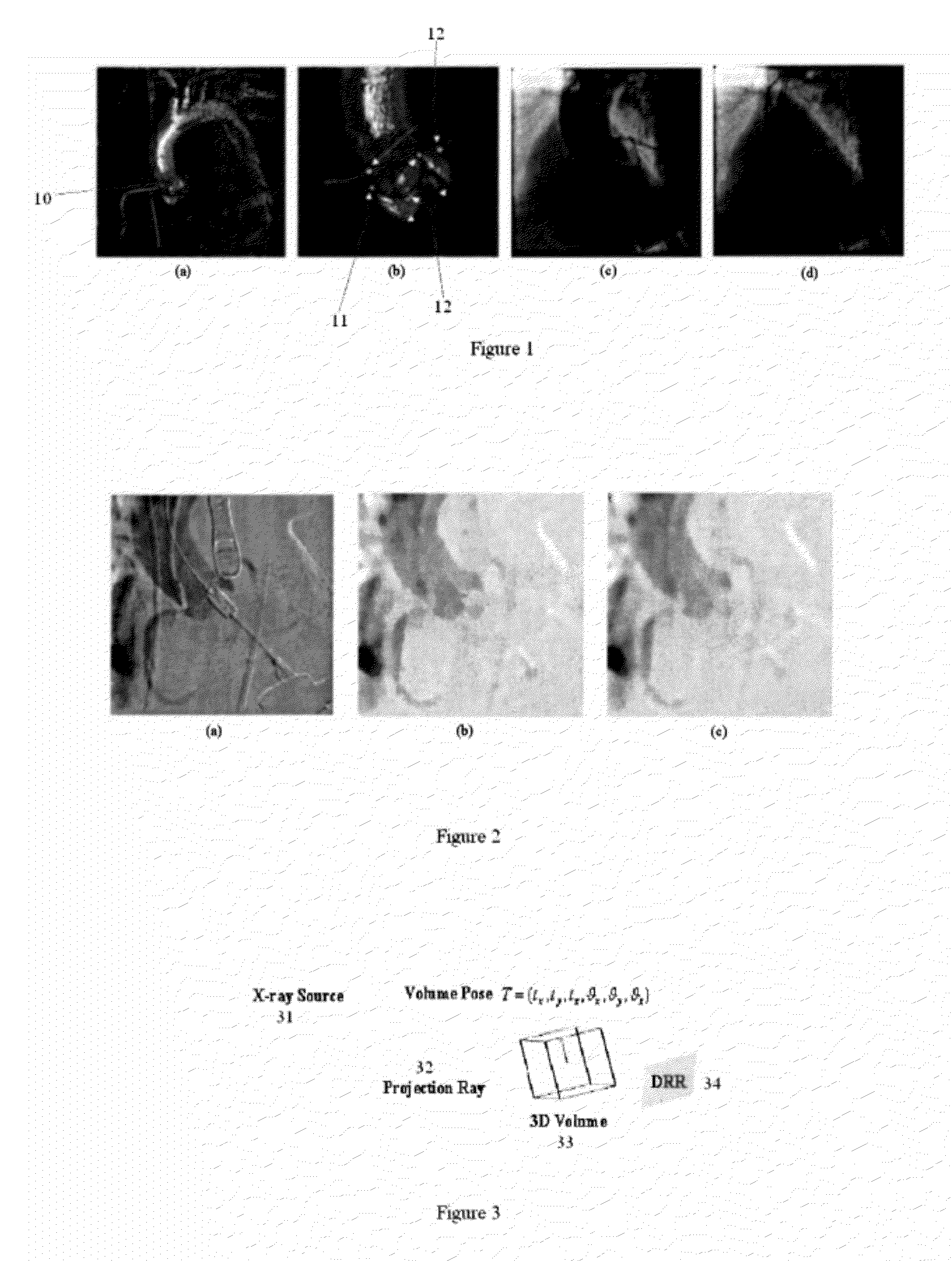 System and method for 2-d/3-d registration between 3-d volume and 2-d angiography