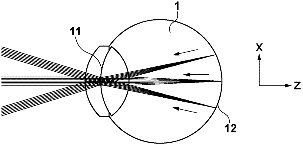 Ophthalmic apparatus, and method of controlling ophthalmic apparatus