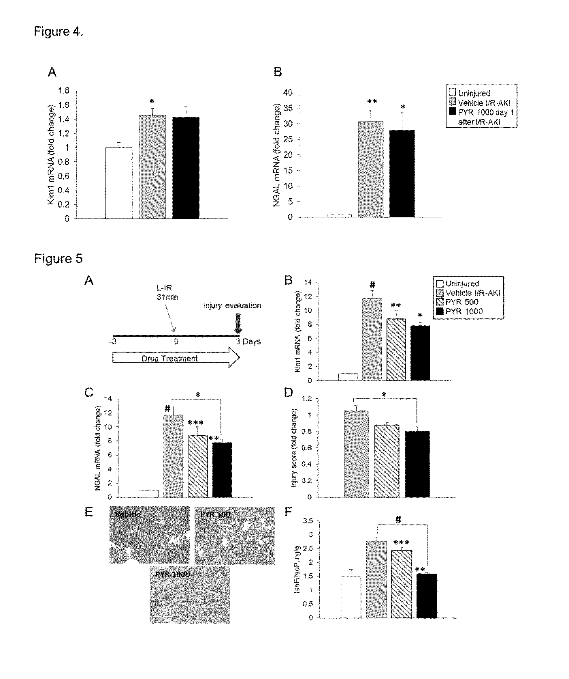 Methods for limiting acute kidney injury