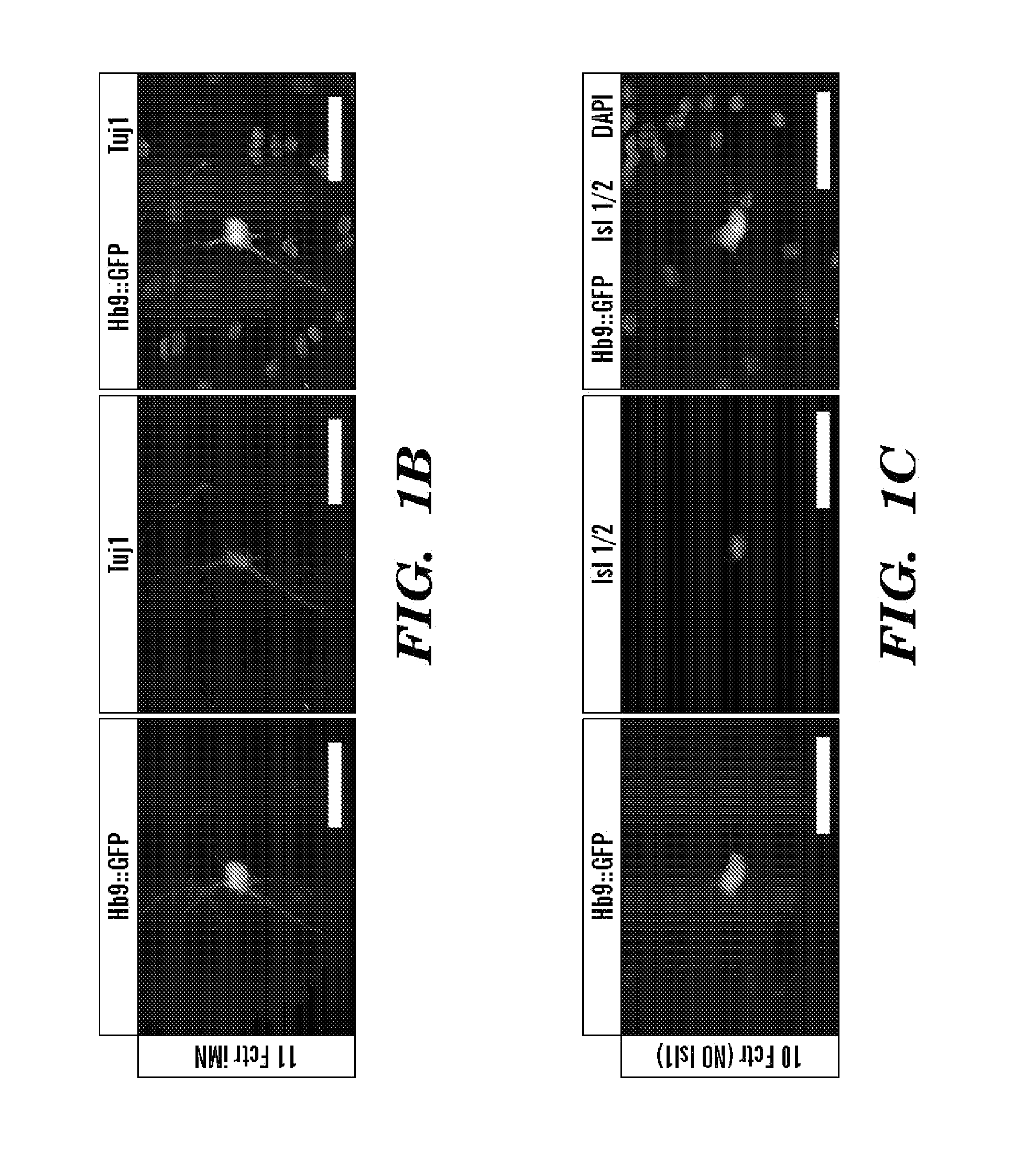 Conversion of somatic cells into functional spinal motor neurons, and methods and uses thereof