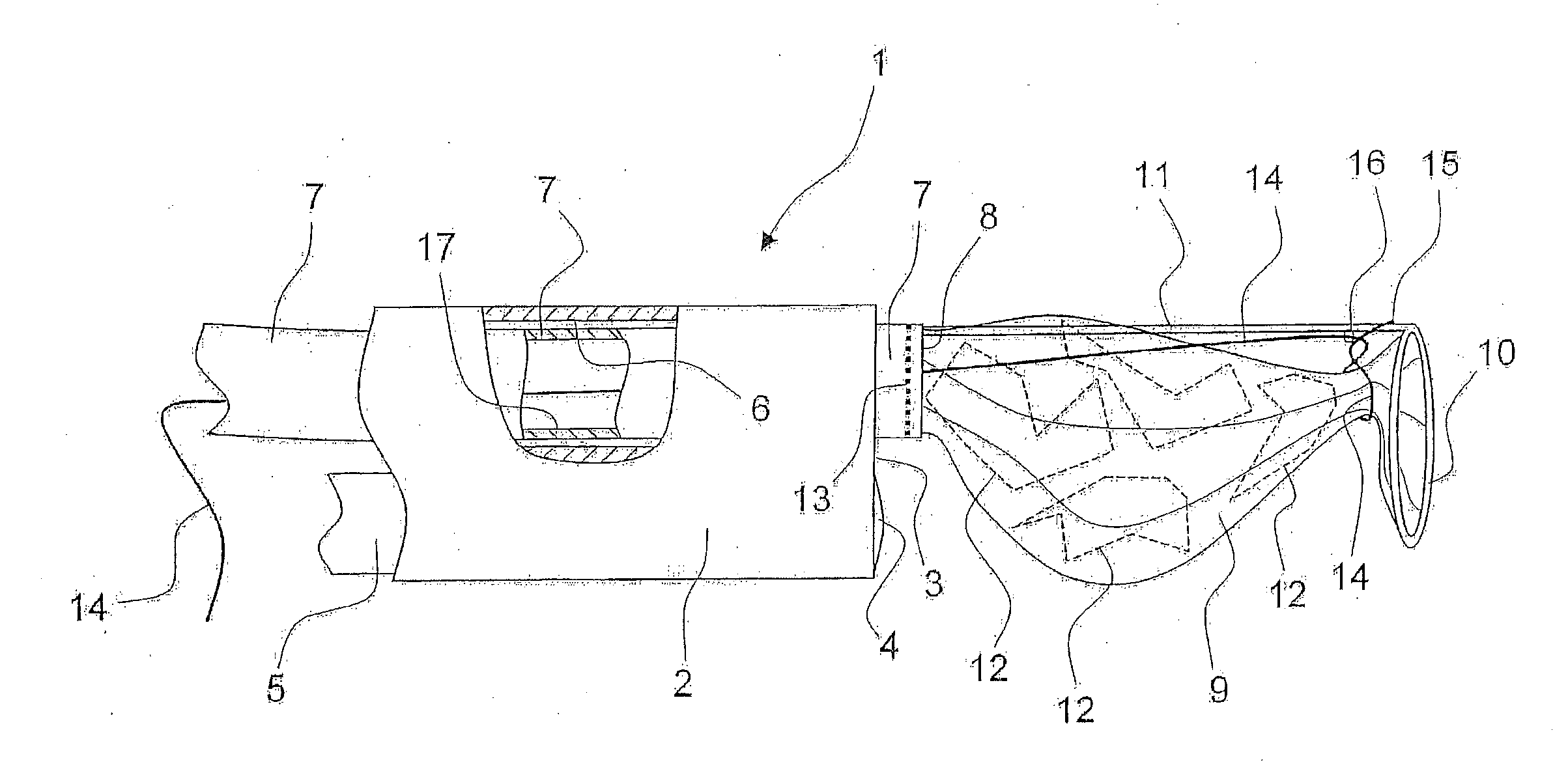 Ureteral calculus suction instrument having a shaft