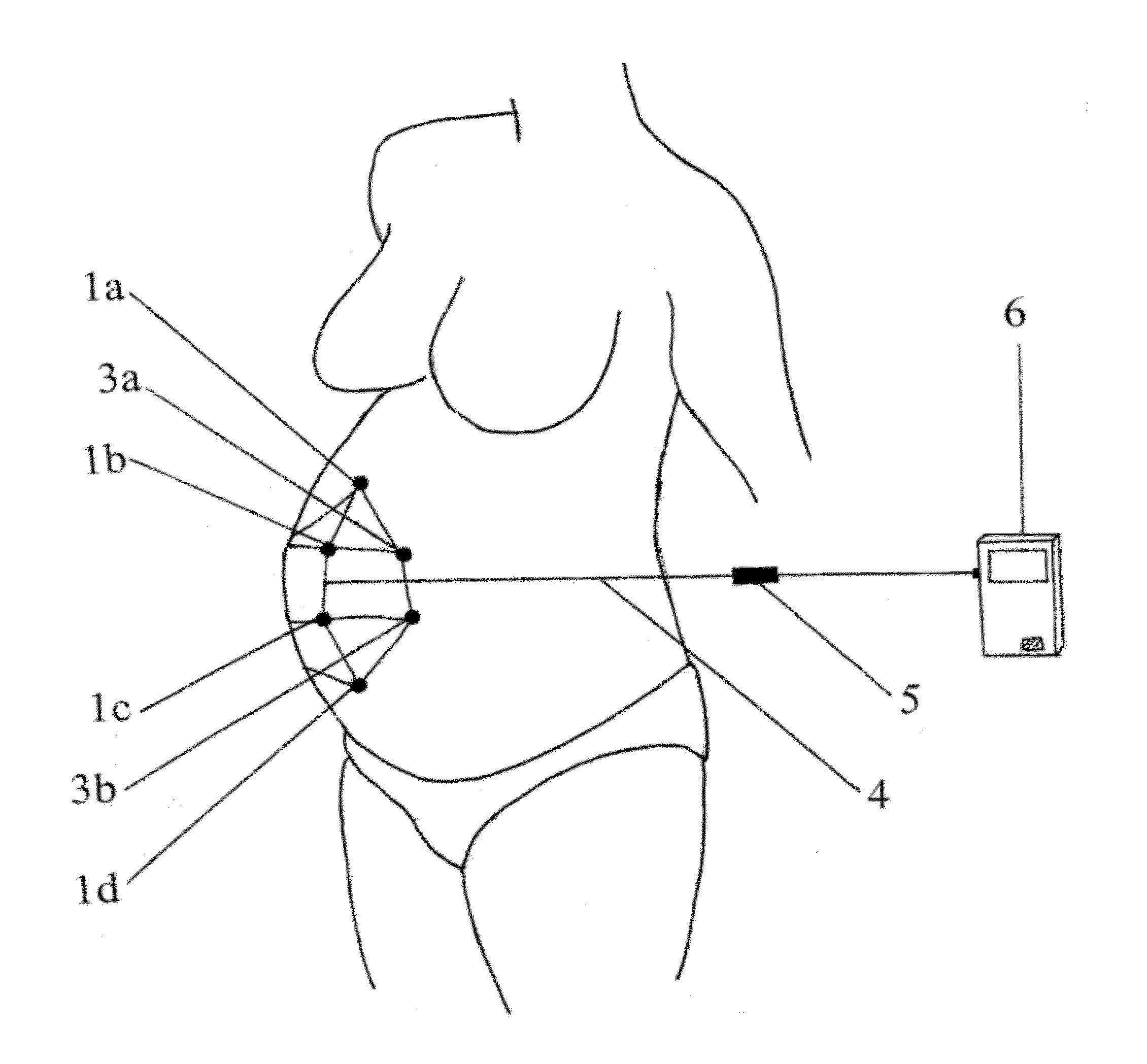 System and Method for Analyzing Progress of Labor and Preterm Labor