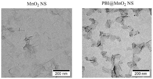 Fluorescent probe for detecting activity of acetylcholin esterase as well as synthesis method and application of fluorescent probe