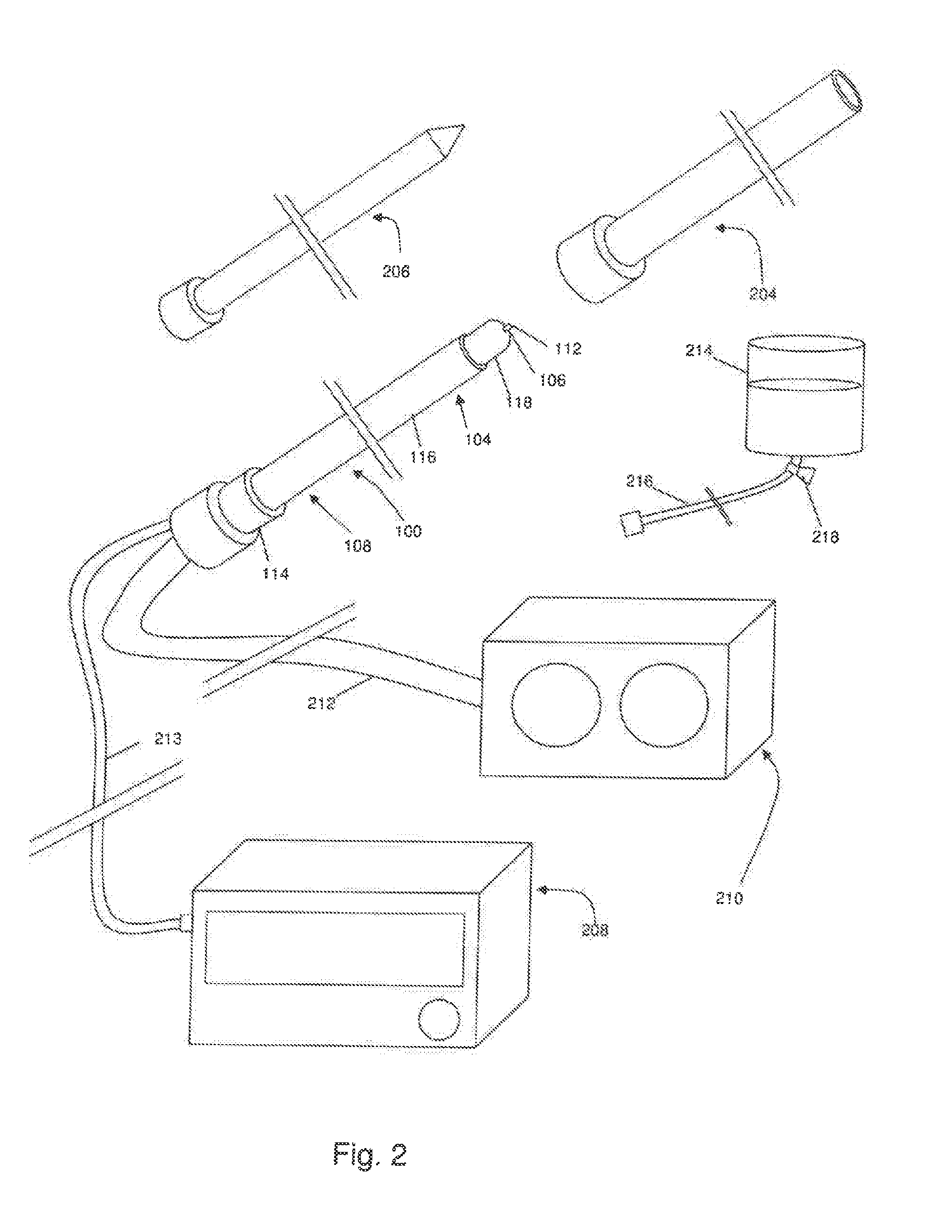 Method for Treating the Thoracic Region of a Patient's Body