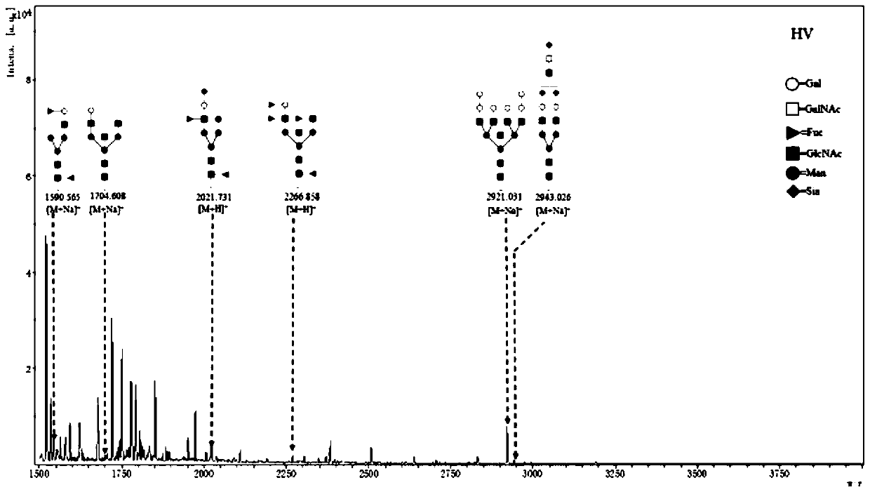 Product for screening and evaluating benign lung diseases based on saliva specific glycoprotein sugar chain structure and application