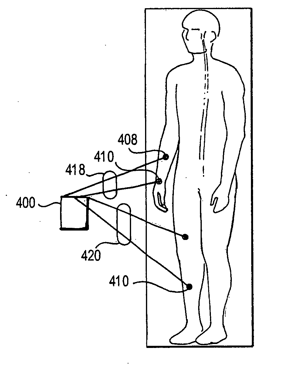 Surface stimulation for tremor control