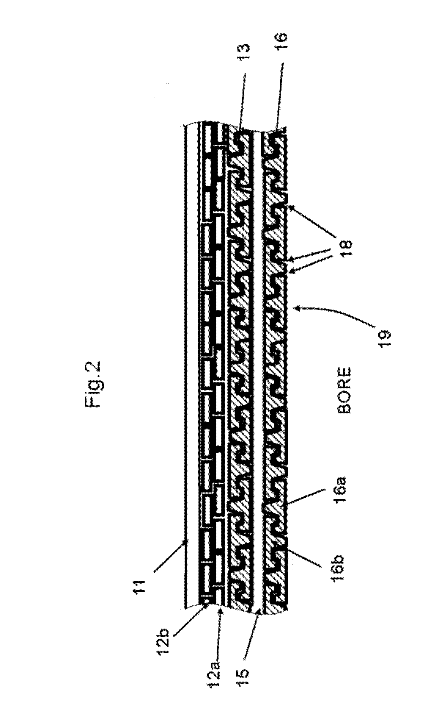 Unbonded flexible pipe