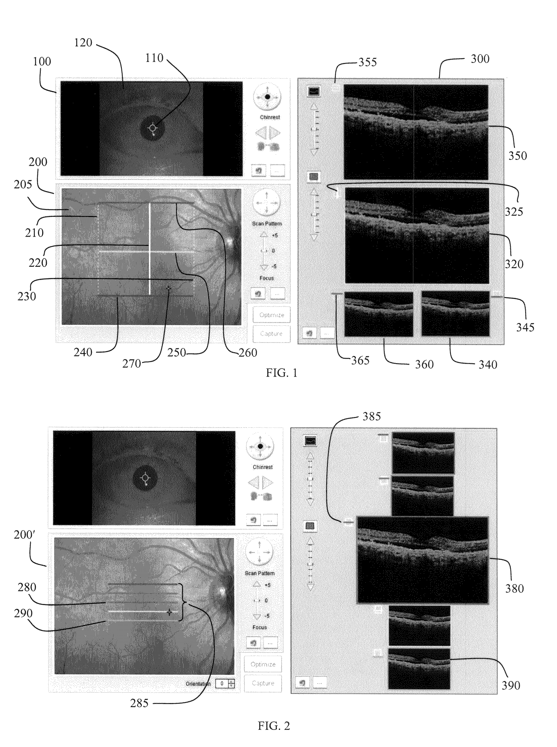 User interface for efficiently displaying relevant oct imaging data