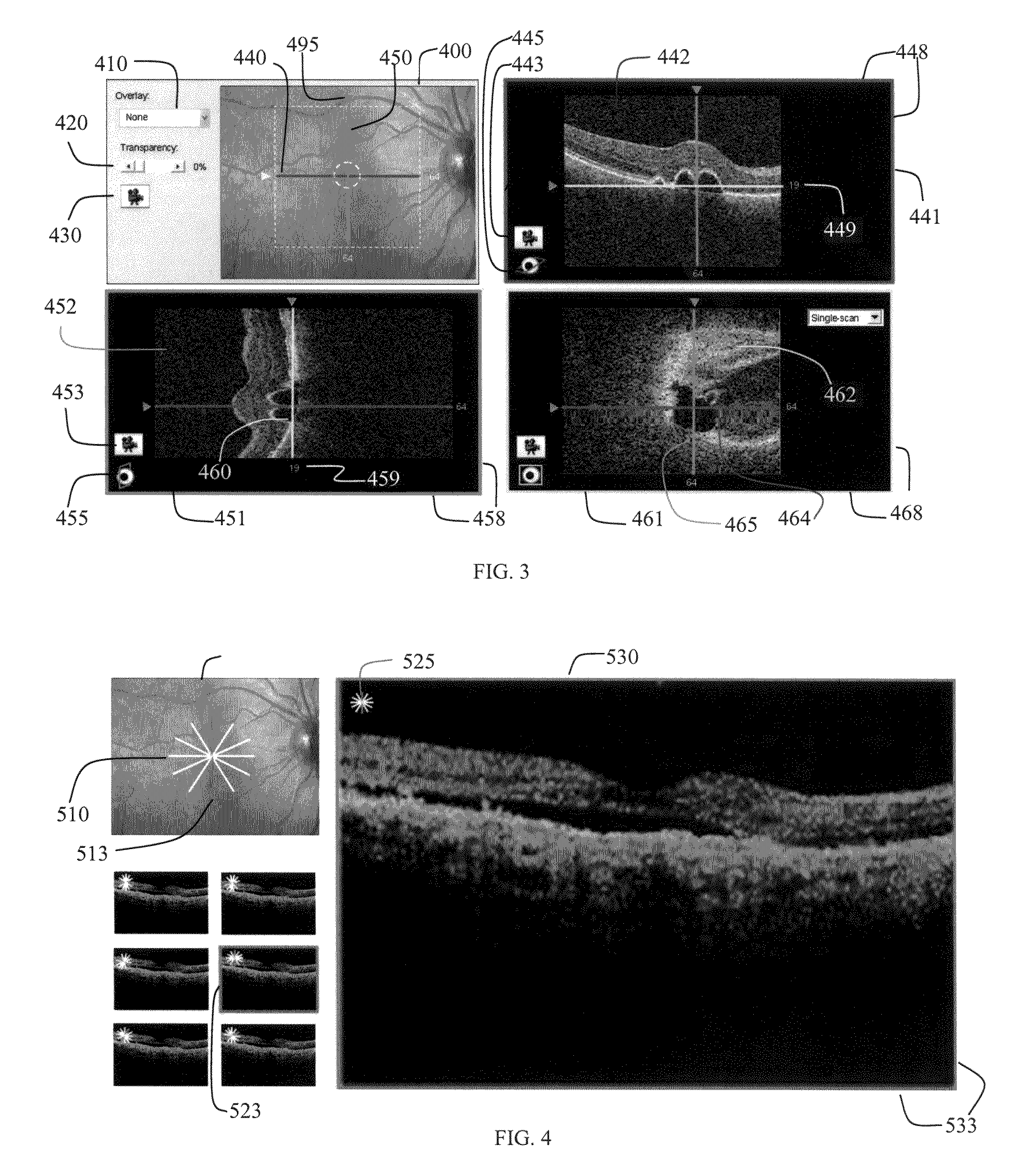 User interface for efficiently displaying relevant oct imaging data