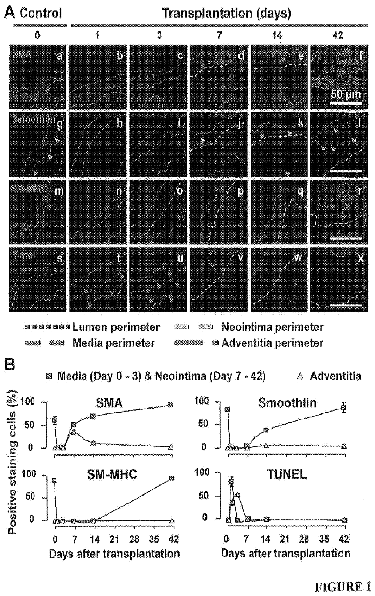 Suppression of neointimal formation following vascular surgeru using cdk8 inhibitors