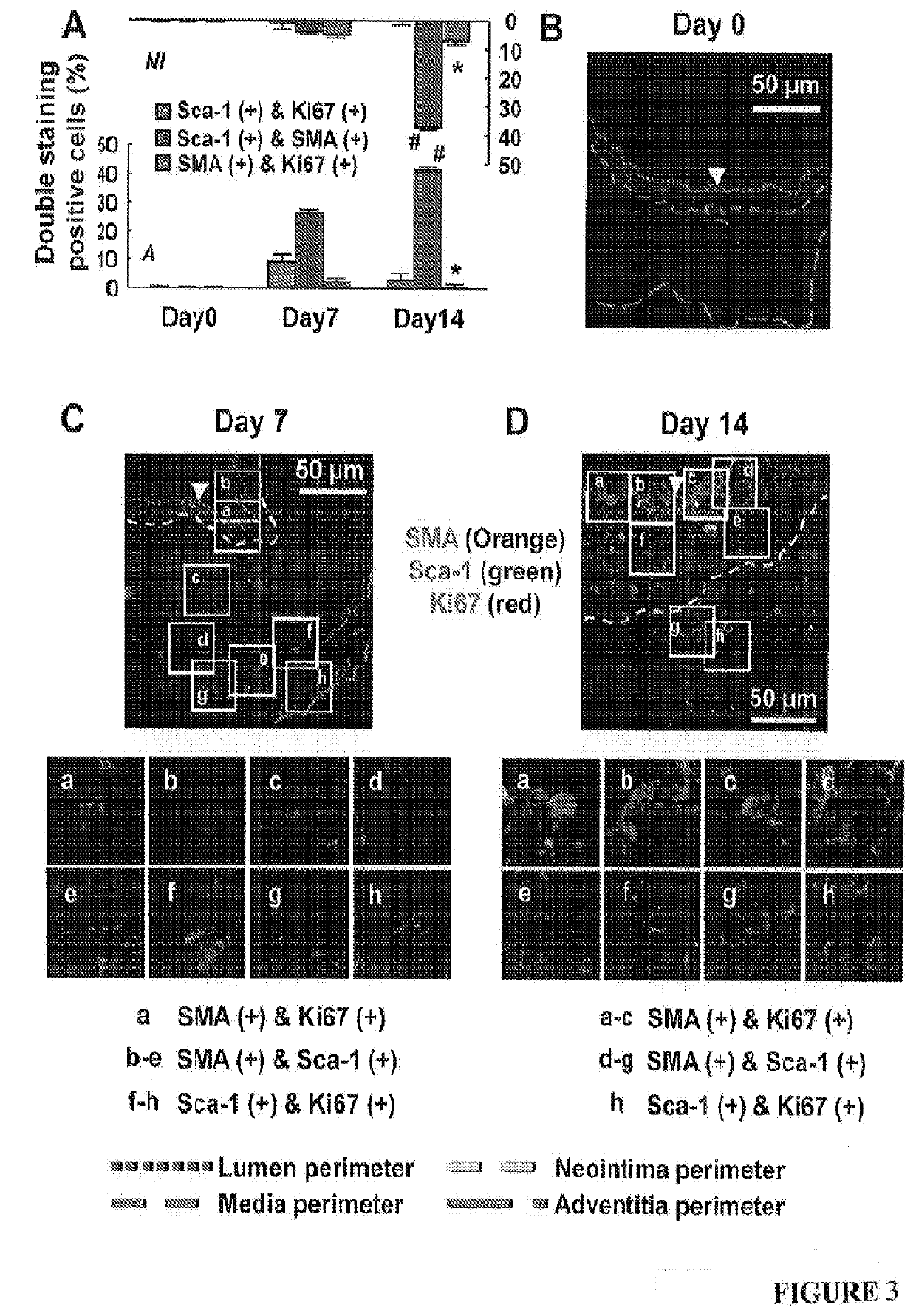 Suppression of neointimal formation following vascular surgeru using cdk8 inhibitors