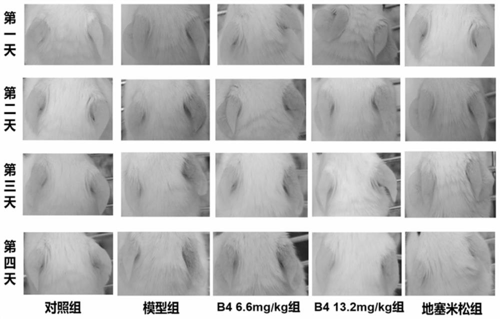 Application of hydroxybetulinic acid compound in preparation of dermatosis drugs