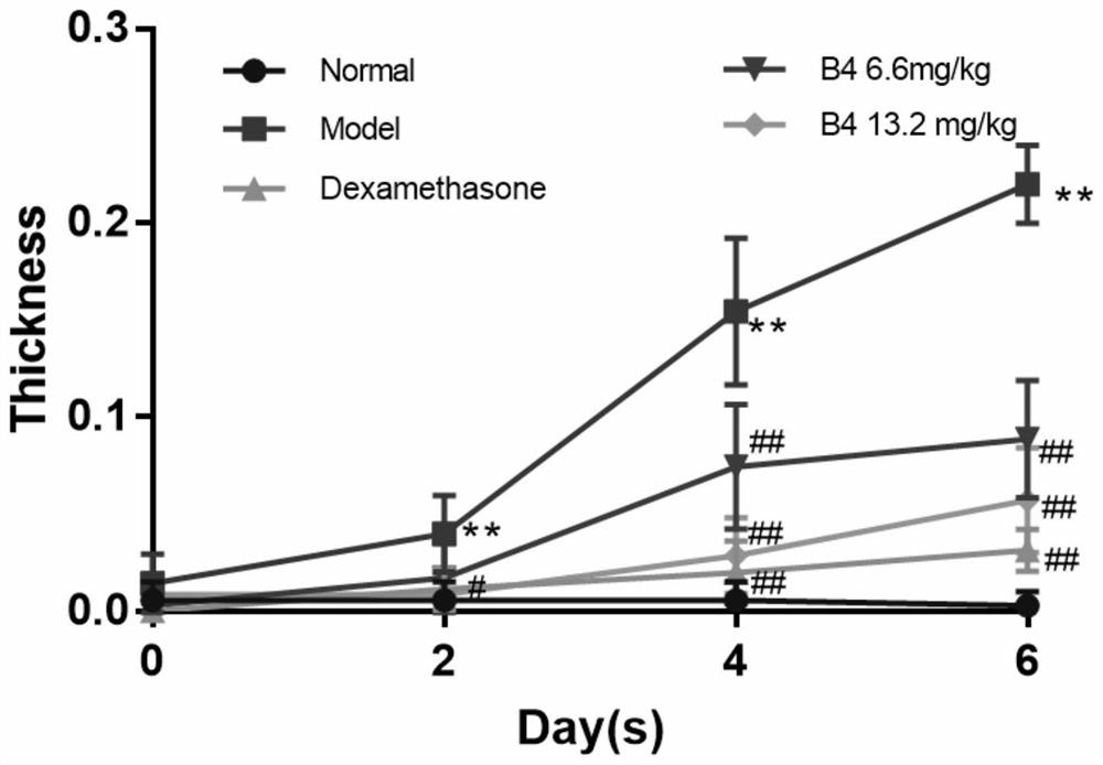 Application of hydroxybetulinic acid compound in preparation of dermatosis drugs