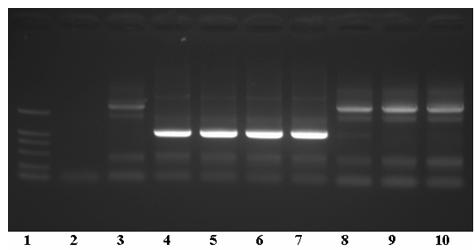 Fusion protein for treating diabetes and preparation method for fusion protein